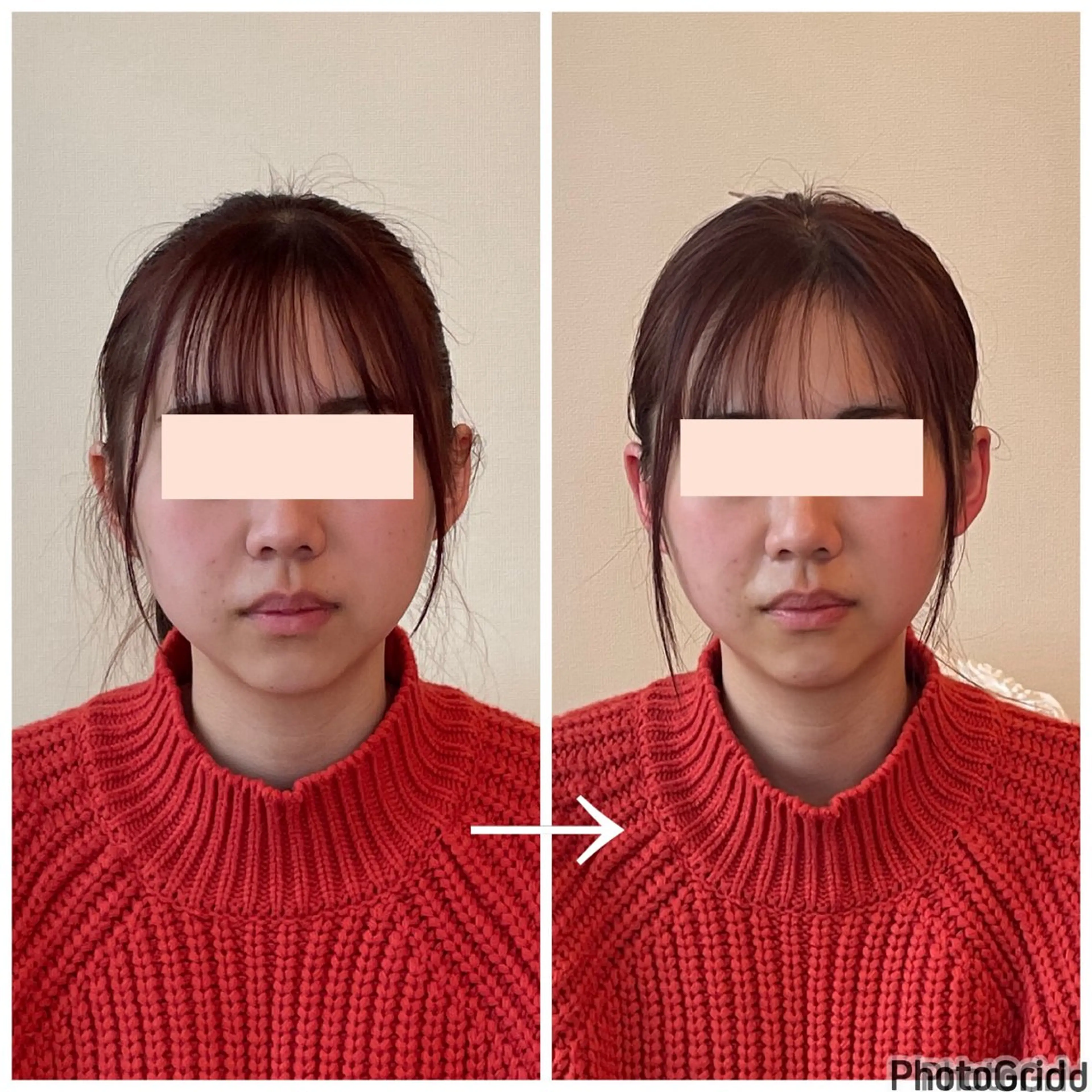 小顔矯正サロン　ReFace Fusae（リフェイスフサエ）所属・小顔矯正サロン リフェイスフサエのエステ・リラクイメージ