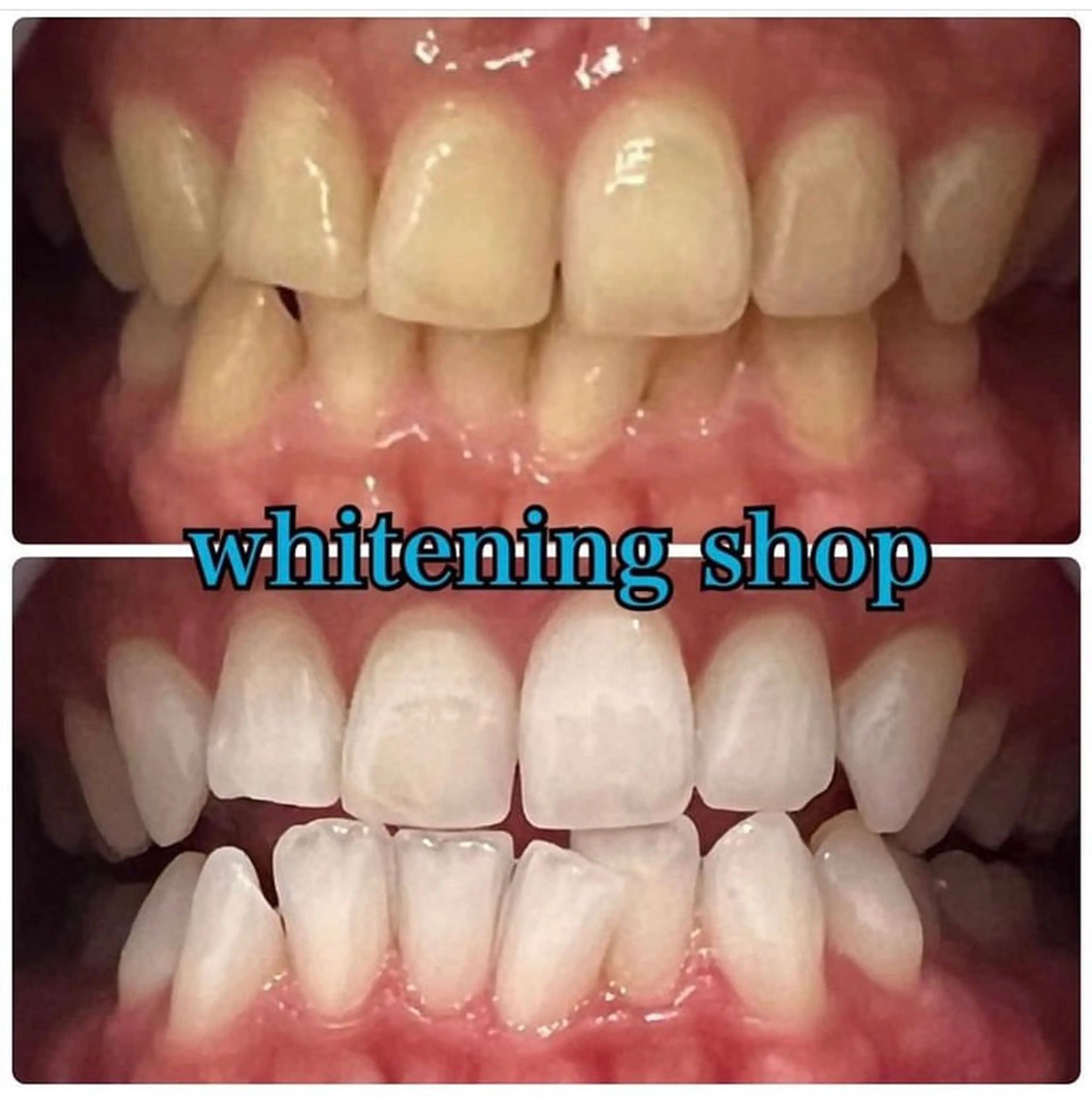 エステ リラク ホワイトニング ショップ吉祥寺店のエステ・リラクイメージ