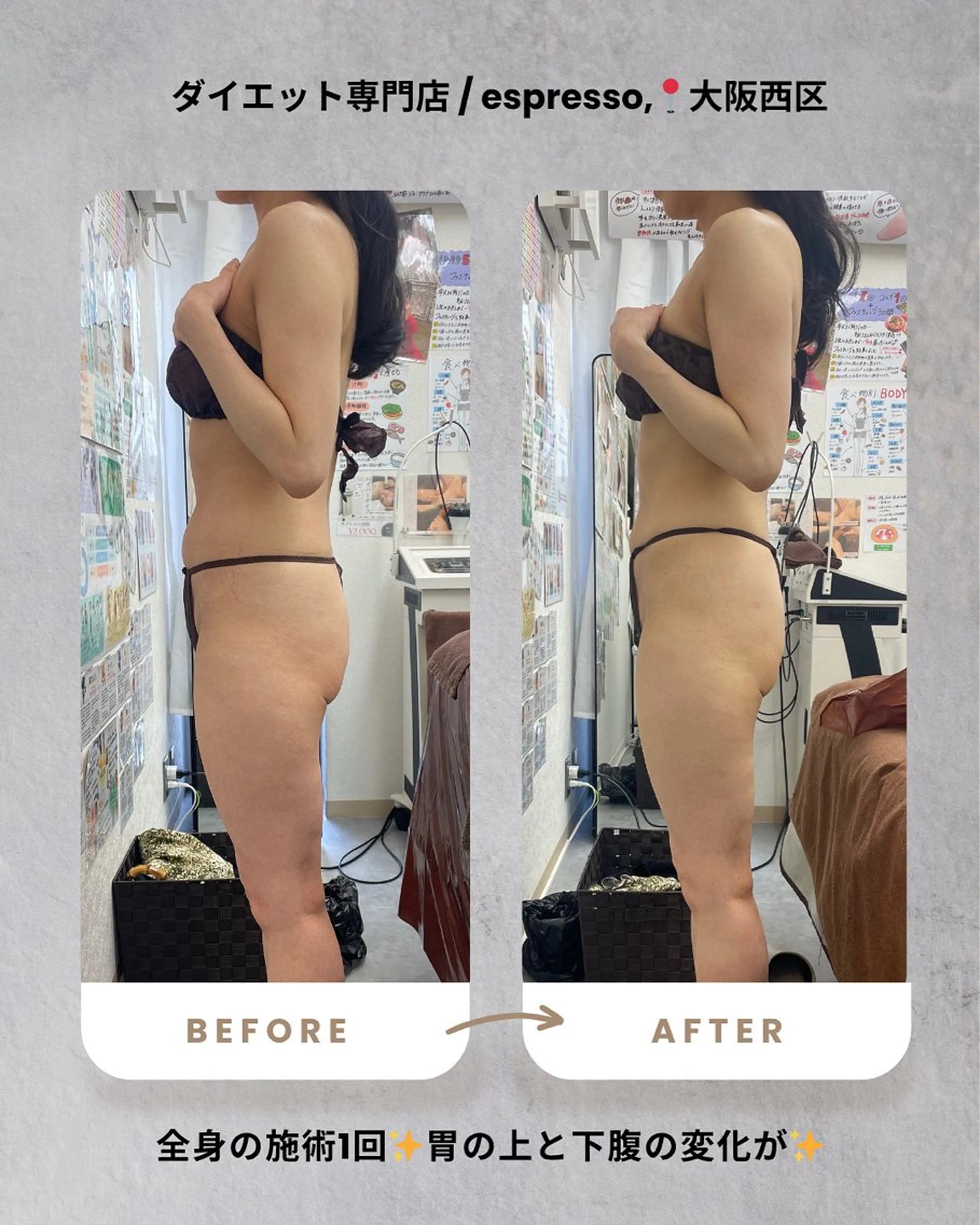 エステ リラク espresso,所属・《痩身、小顔専門店》 エスプレッソのエステ・リラクイメージ