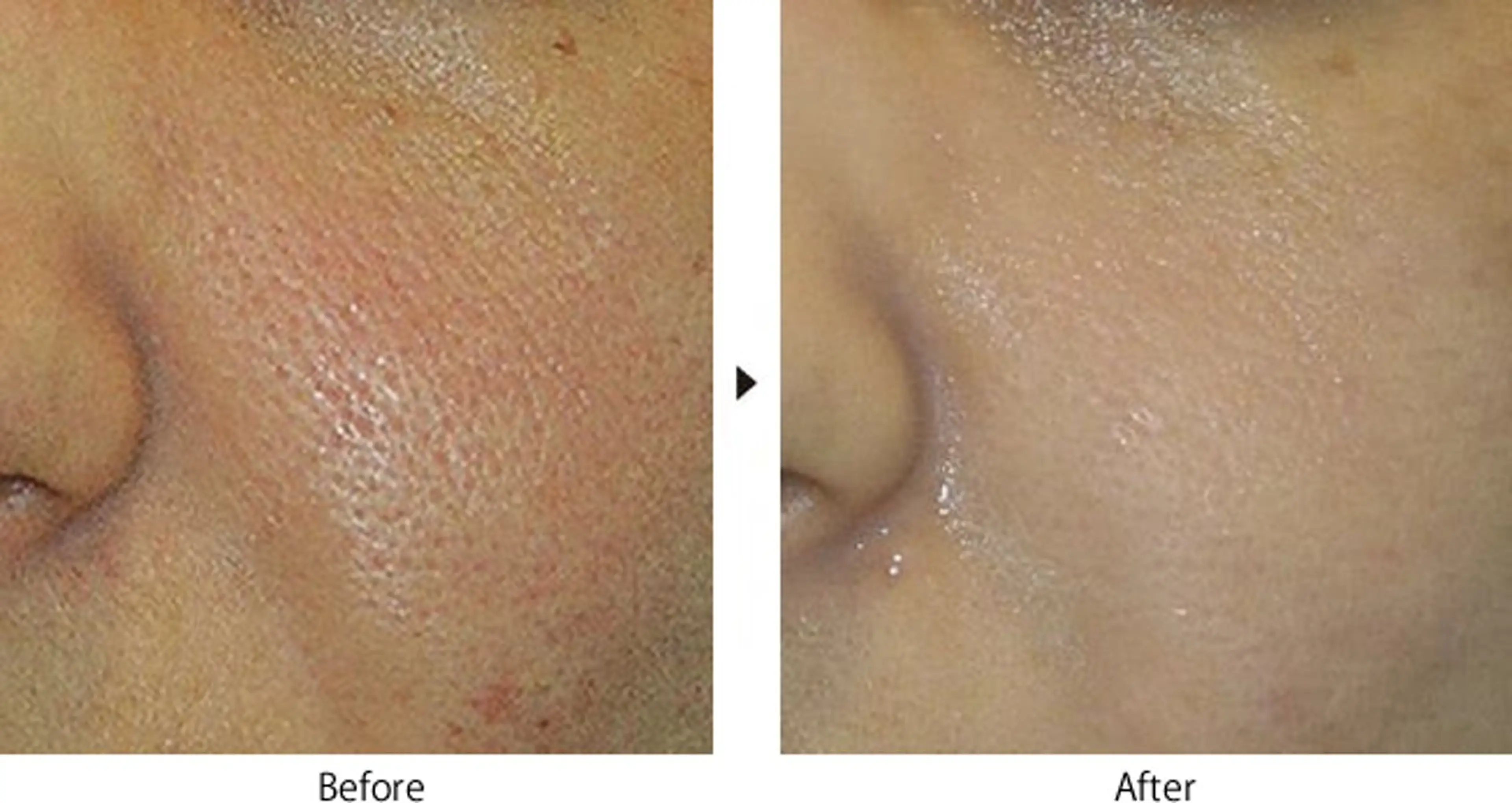 撮影モデル total beauty HAPPY所属・O. Minaのその他イメージ