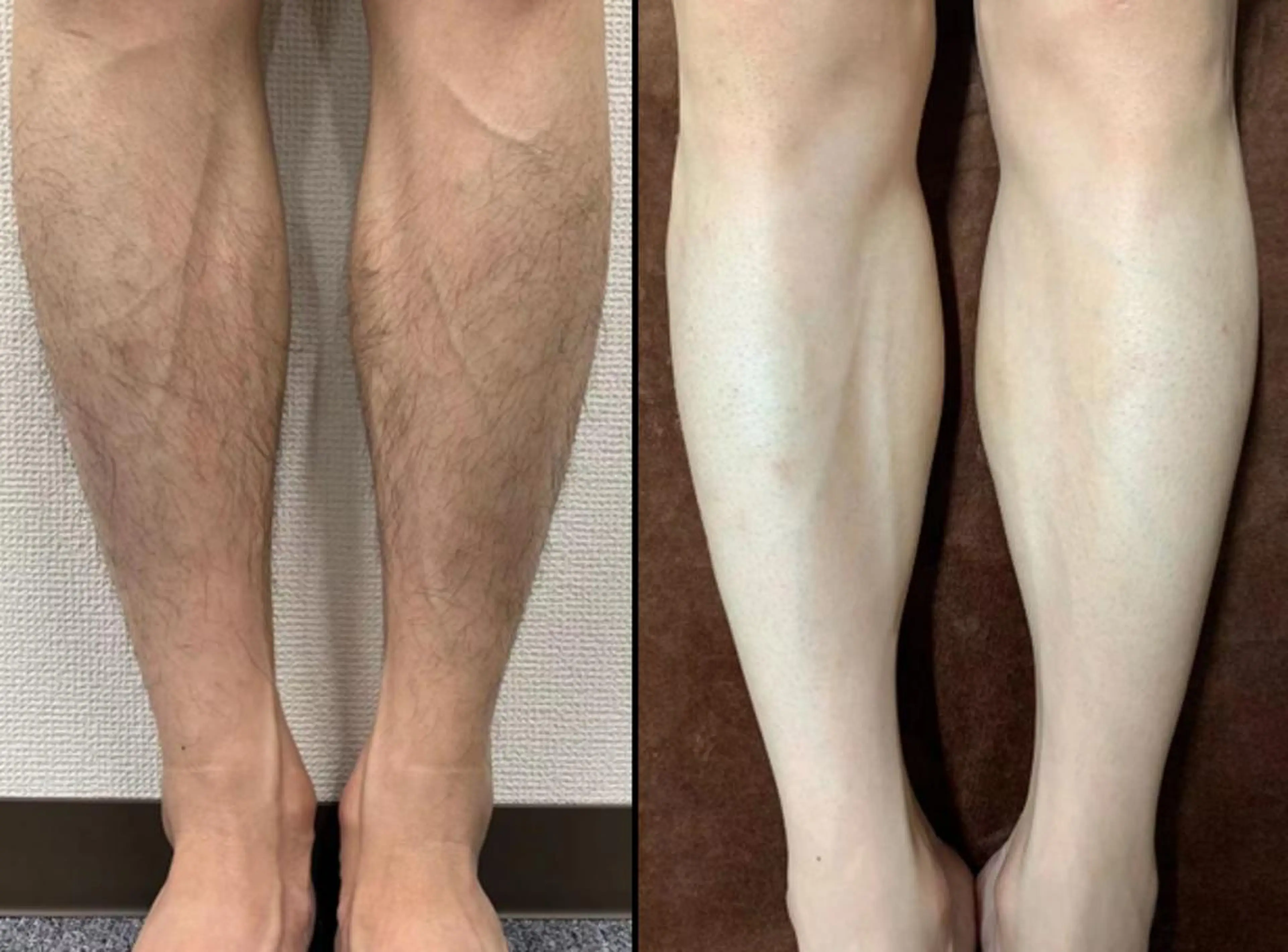 全身脱毛×マッサージ 高岳×新栄×代官町の眉毛・アイブロウイメージ