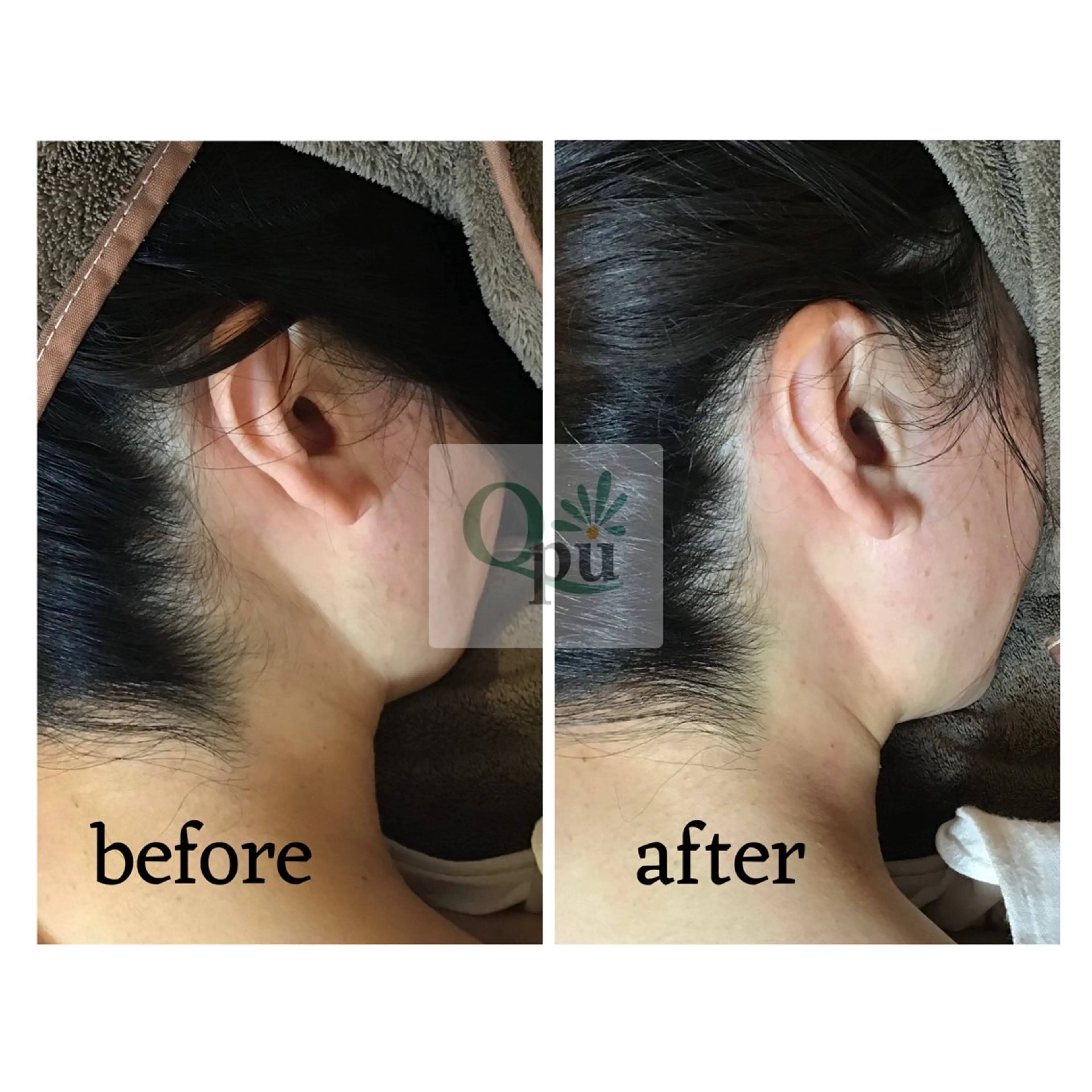 脱毛 Qpu(キュープ)下北沢店所属・鮎川 さゆりのエステ・リラクイメージ