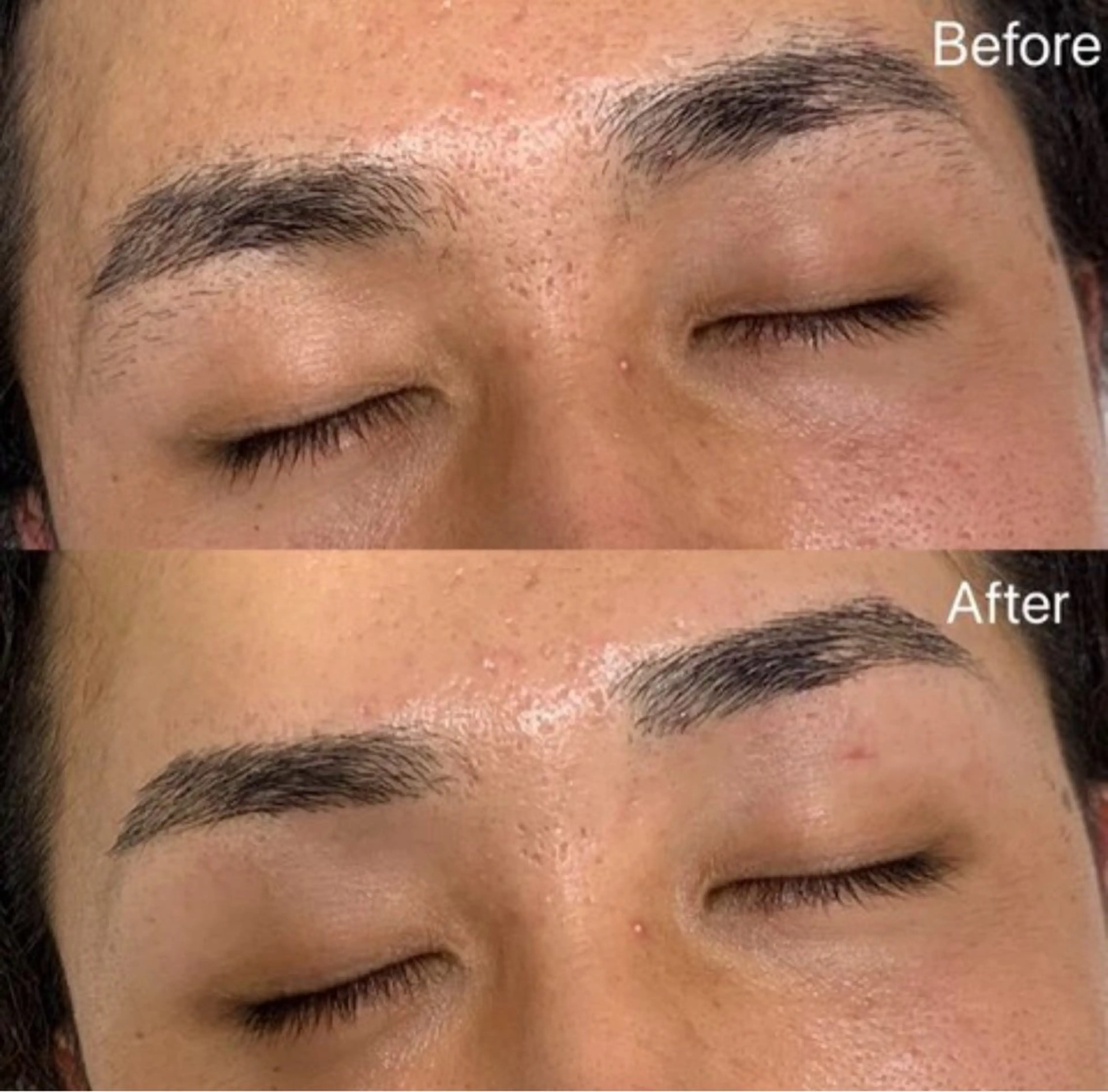 HBL練習モデルの写真