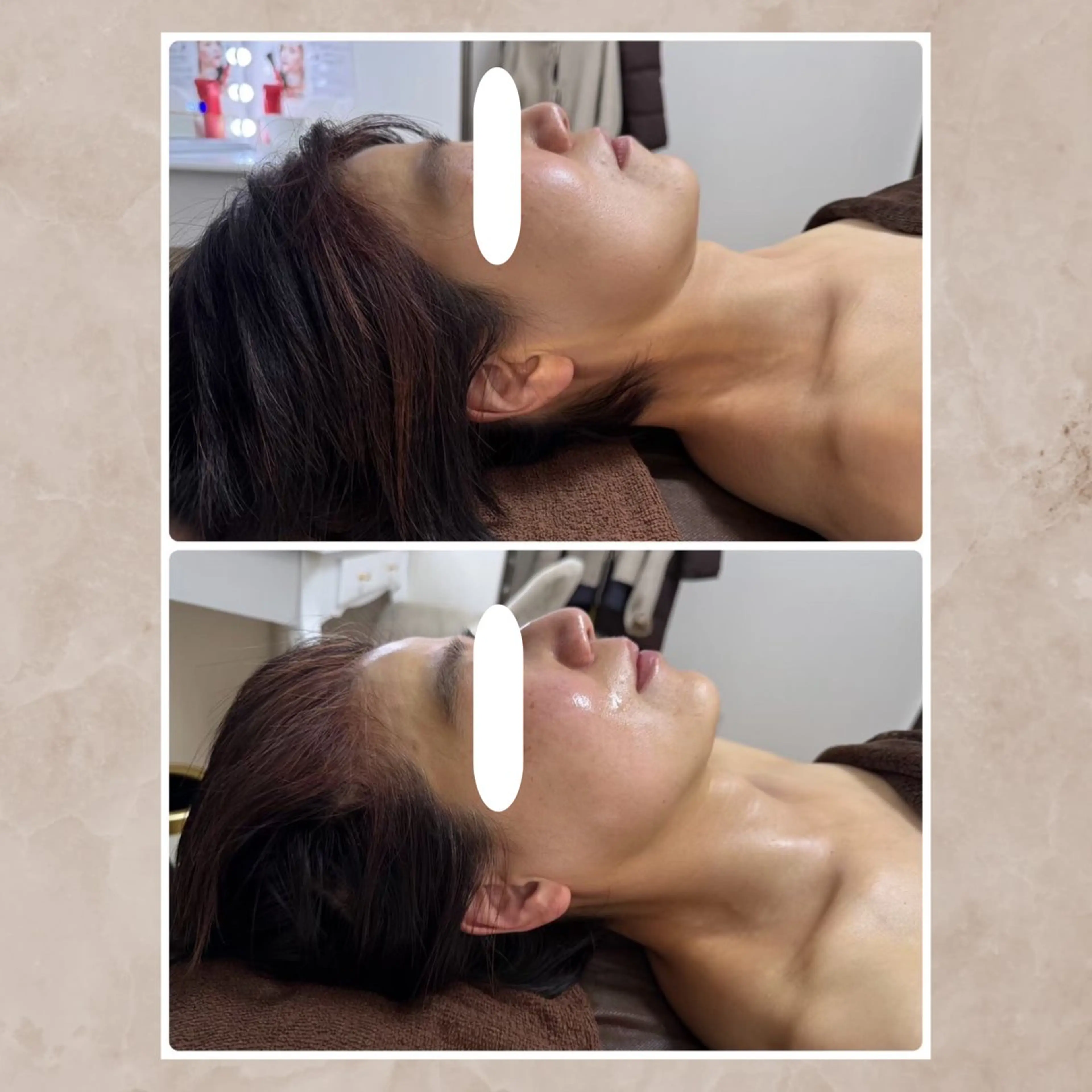 Total Beauty Salon Vi's CLUB by BINEL所属・Vi's CLUB KOTONOのエステ・リラクイメージ