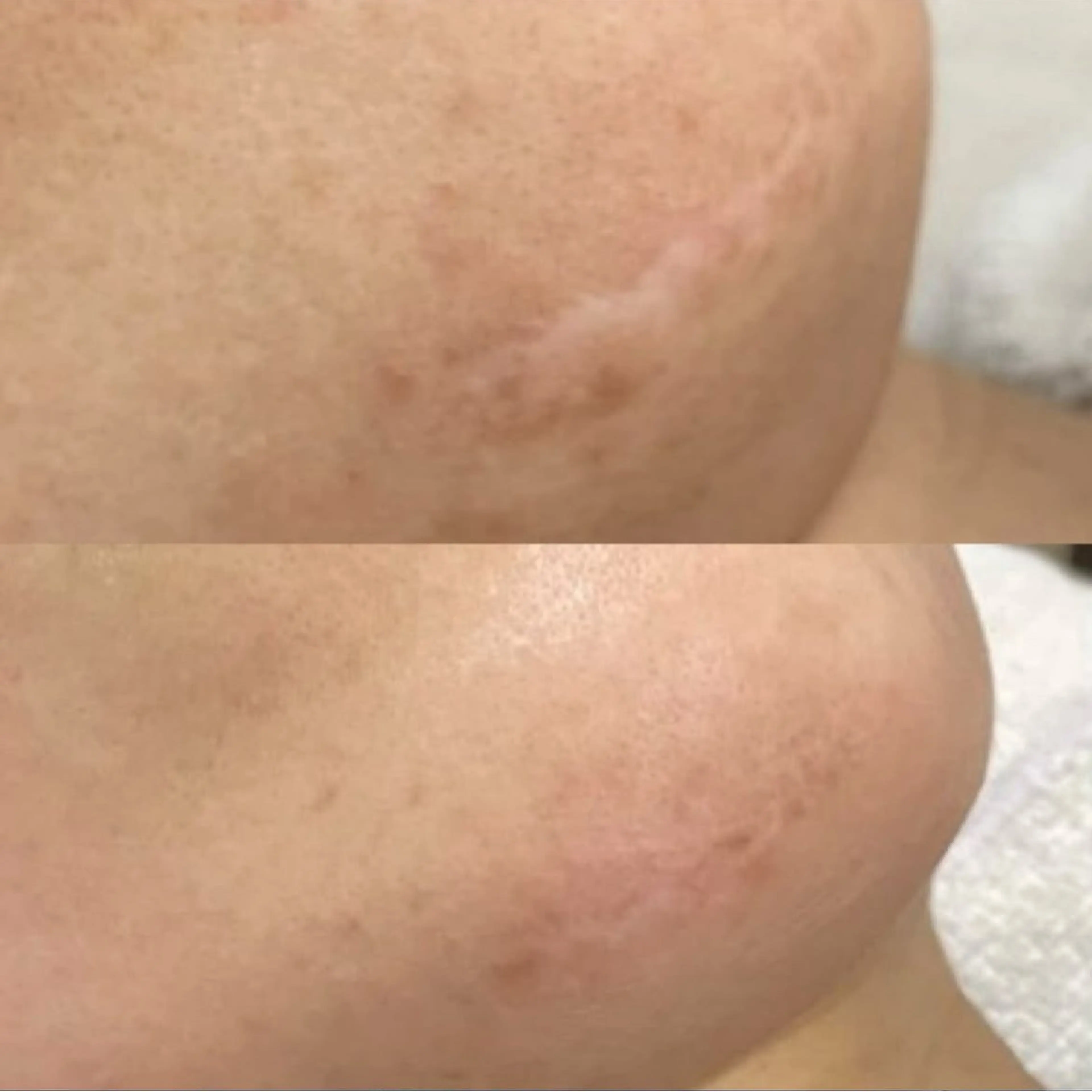 Blooming所属・LOUISE. ／肌質・頭皮のエステ・リラクイメージ