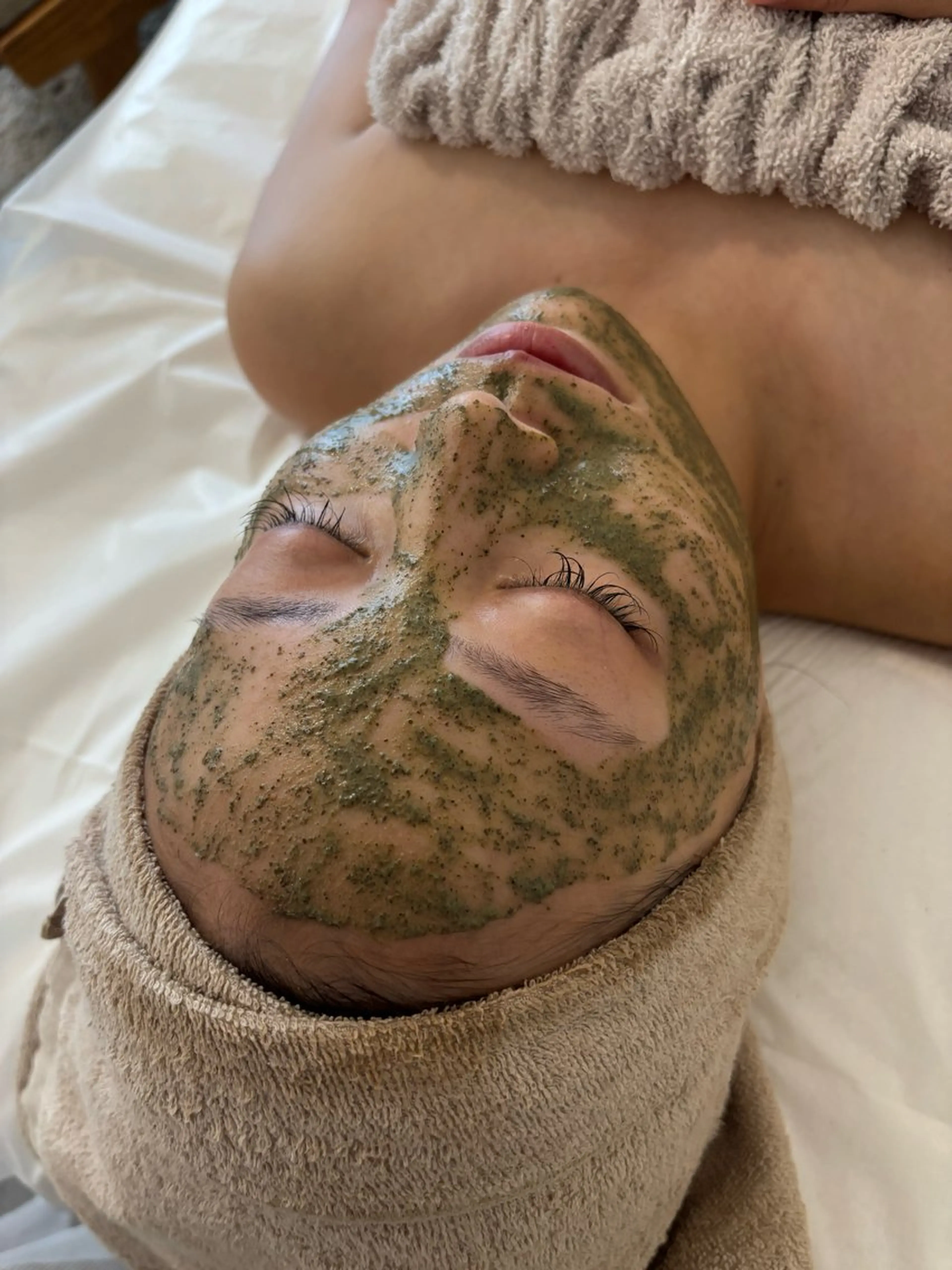 【人気No.1】本気の肌質改善★REVIハーブピーリングの写真