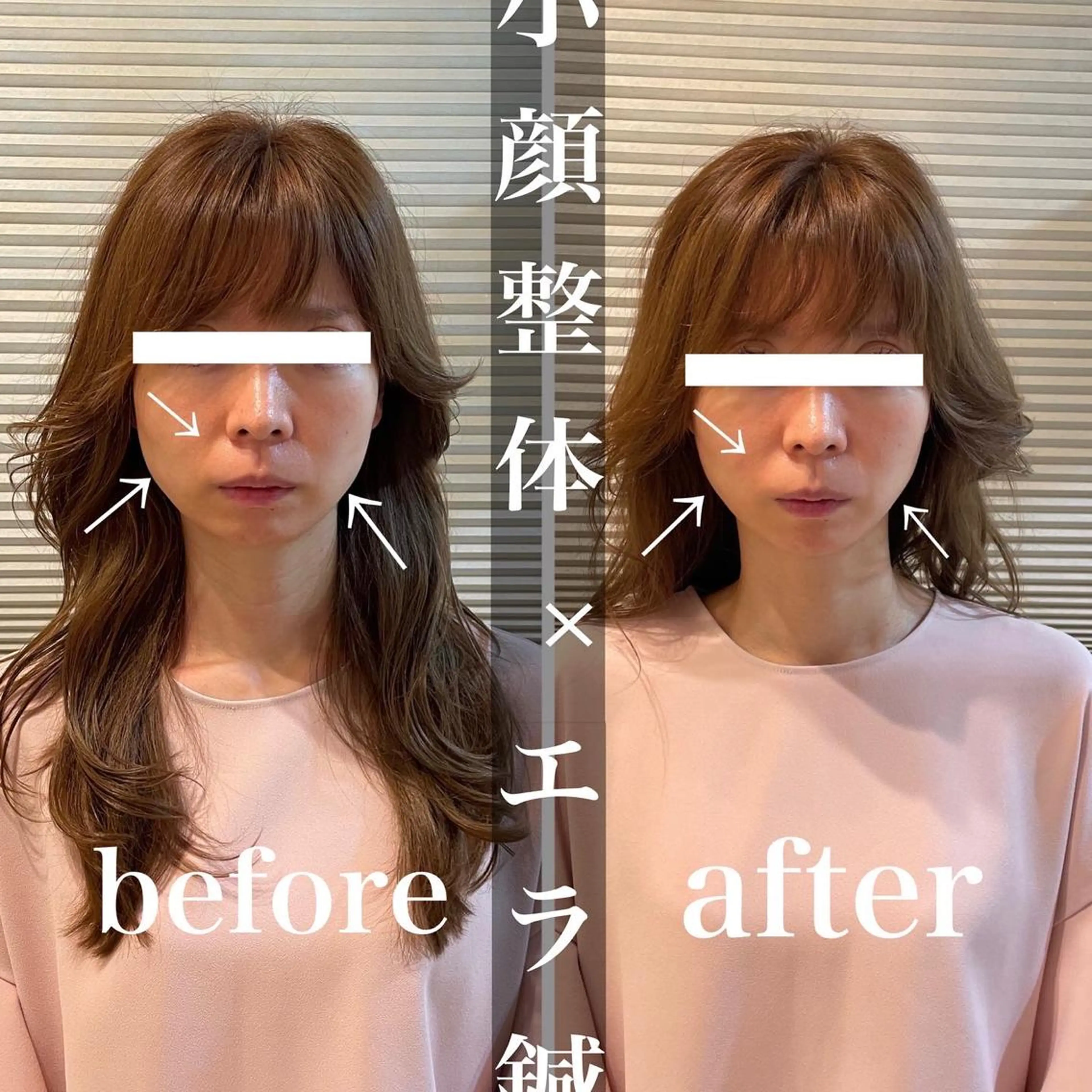 鍼灸整骨院Refine所属・鍼灸 Refineのその他イメージ