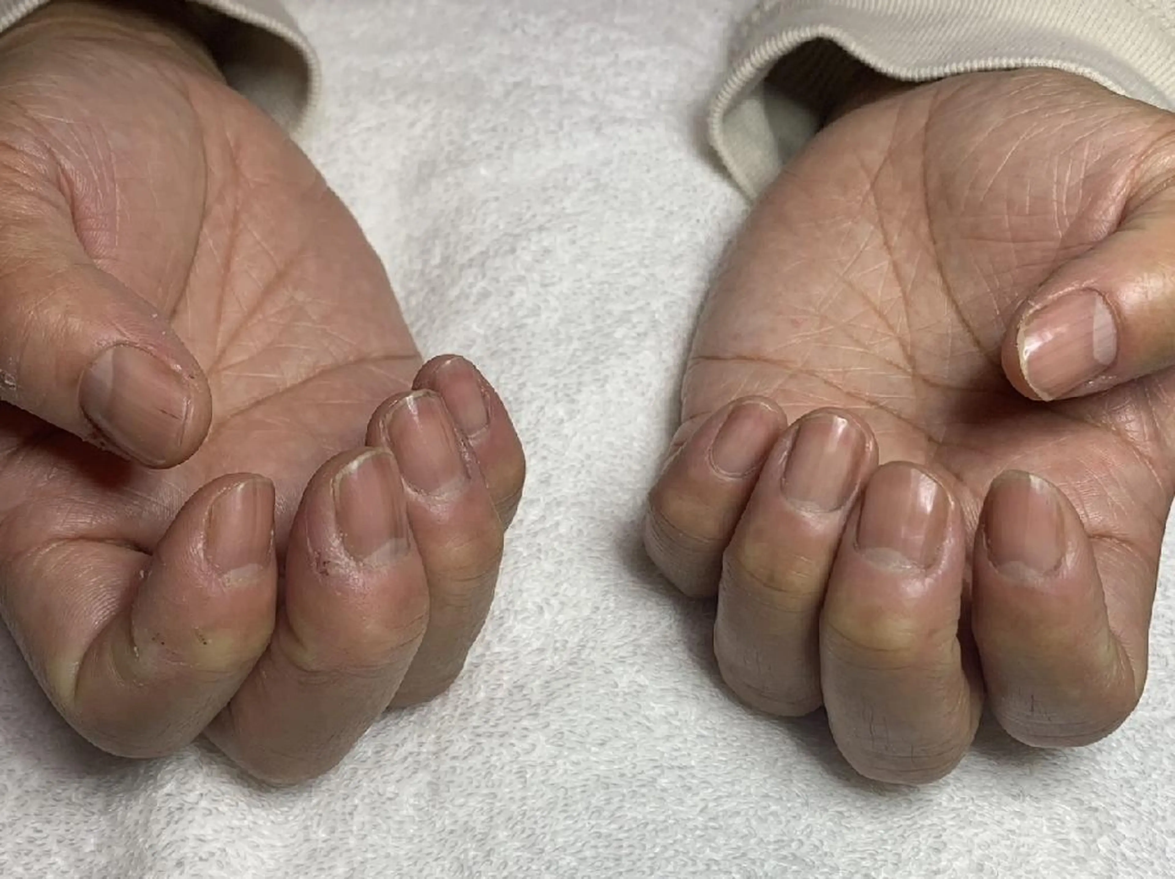 ネイル carenail　 tsugumiのその他イメージ