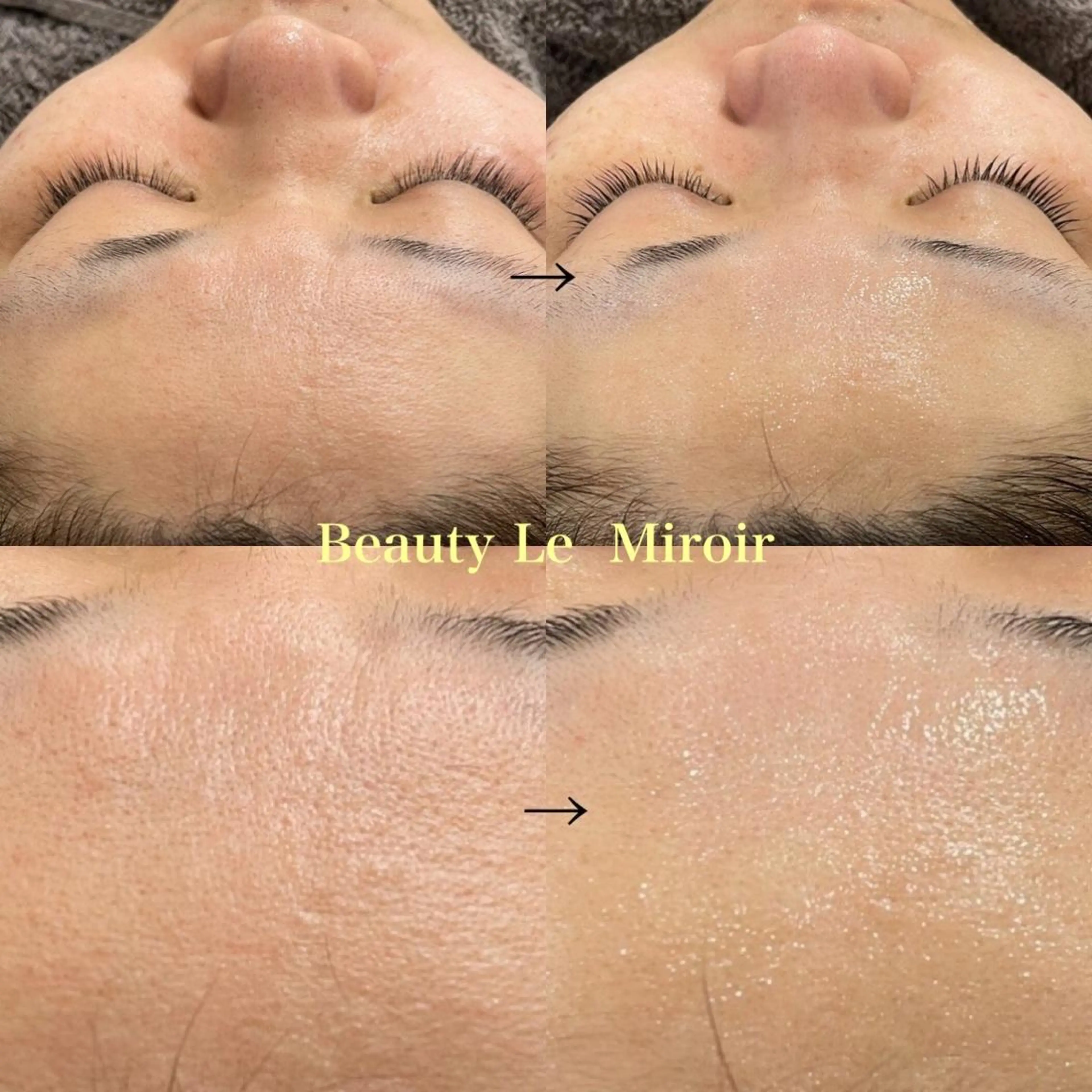 マツエク・マツパ ビューティー ミロワールのエステ・リラクイメージ