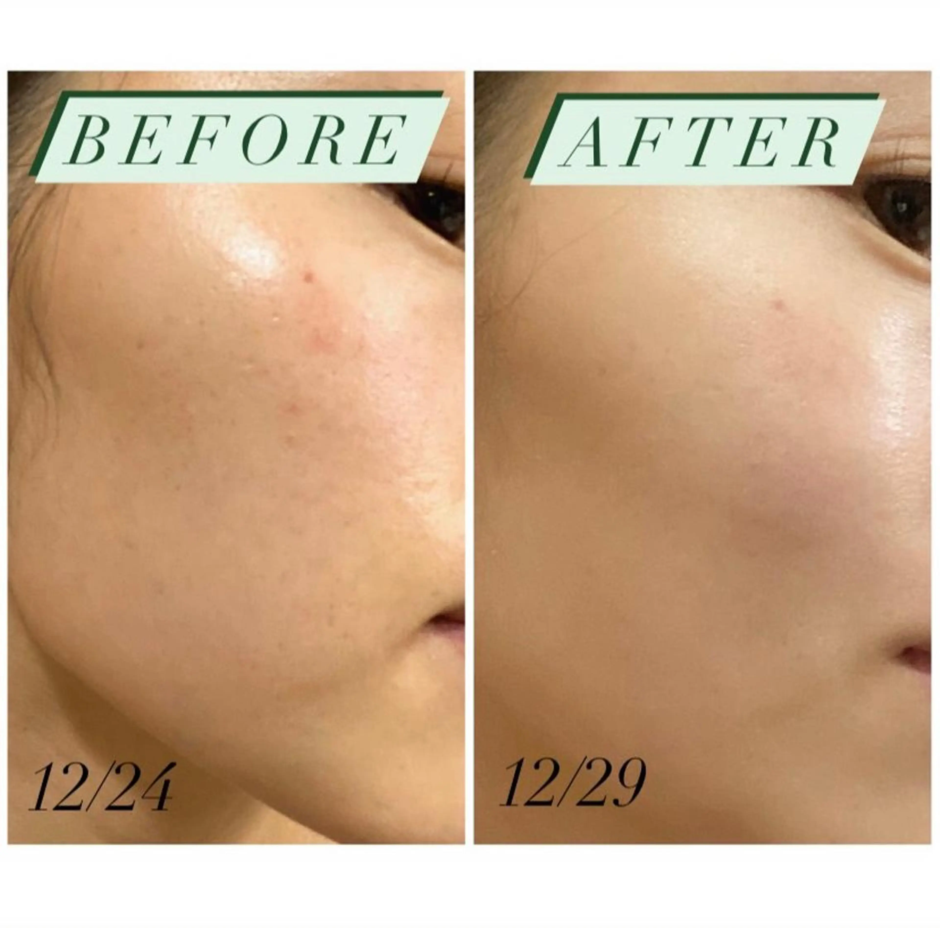 ハーブピーリング・毛穴ケア専門サロンSalon de LENA所属・ハーブピーリング 専門店/名古屋駅前店のその他イメージ