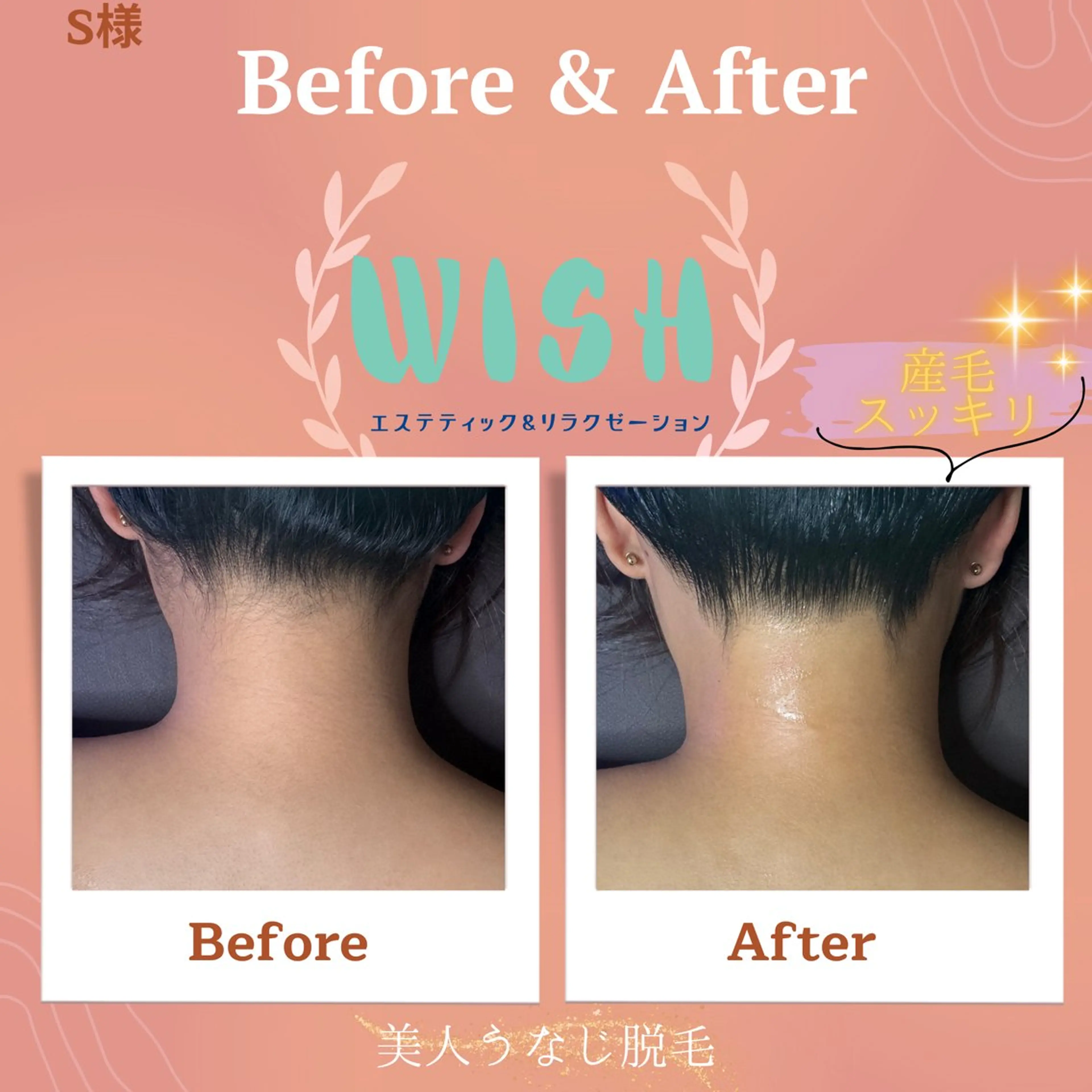 WISH 美肌脱毛のプロ！須藤のエステ・リラクイメージ
