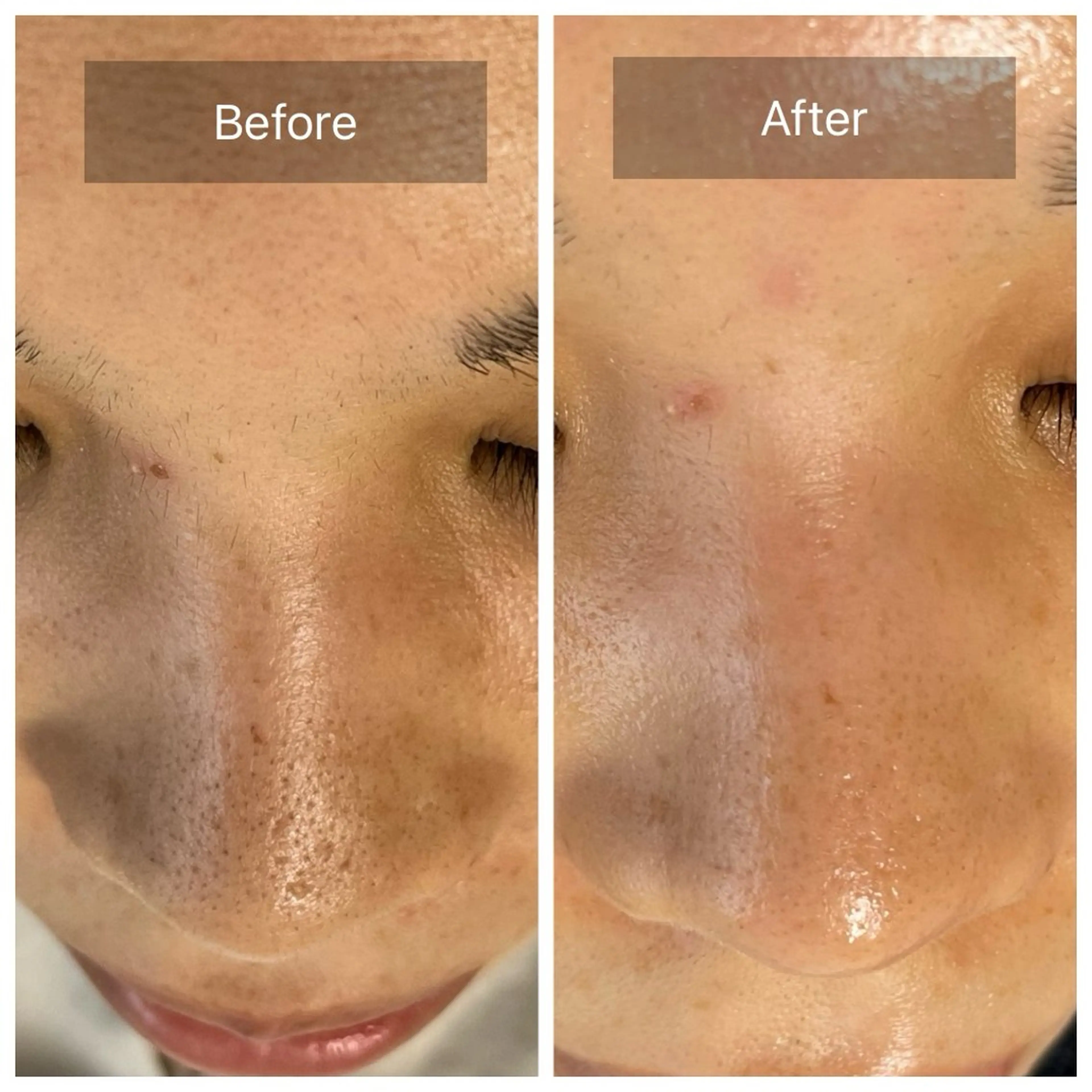 毛穴が見えなくなるサロン  Horo所属・岡 えり子のエステ・リラクイメージ