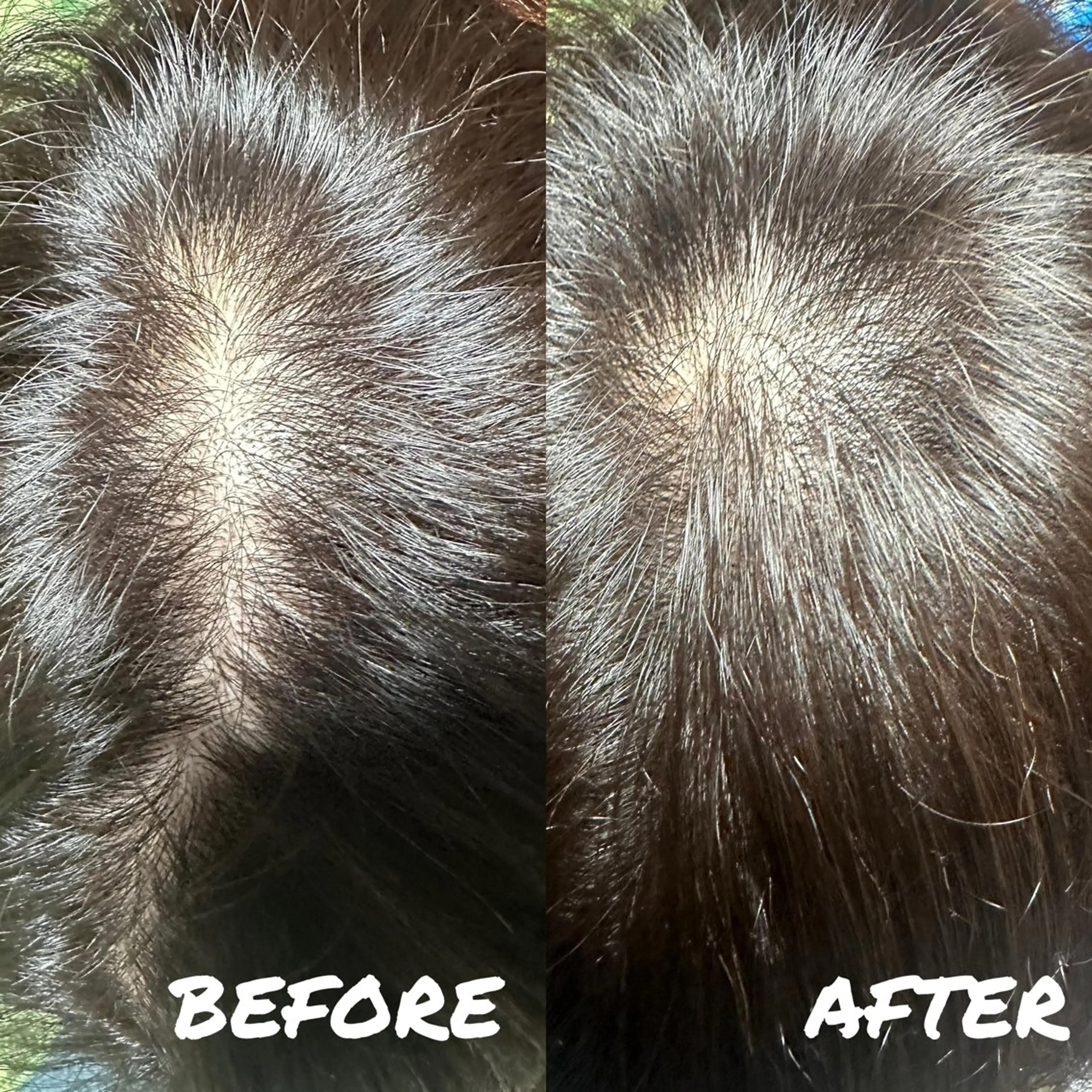 増毛エクステ300本(黒髪、茶髪の方)の写真