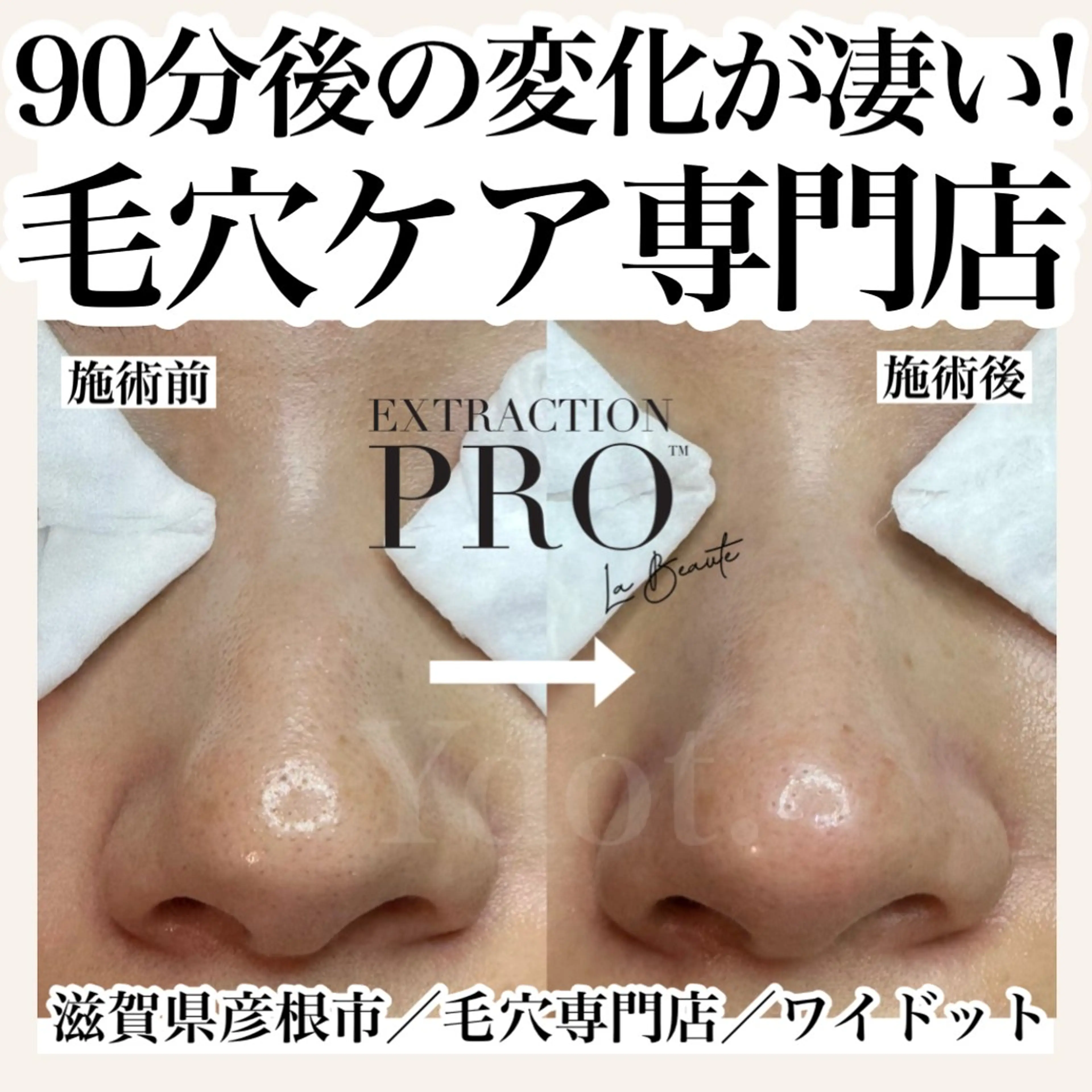 エステ Ydot. 池内 友架のエステ・リラクイメージ