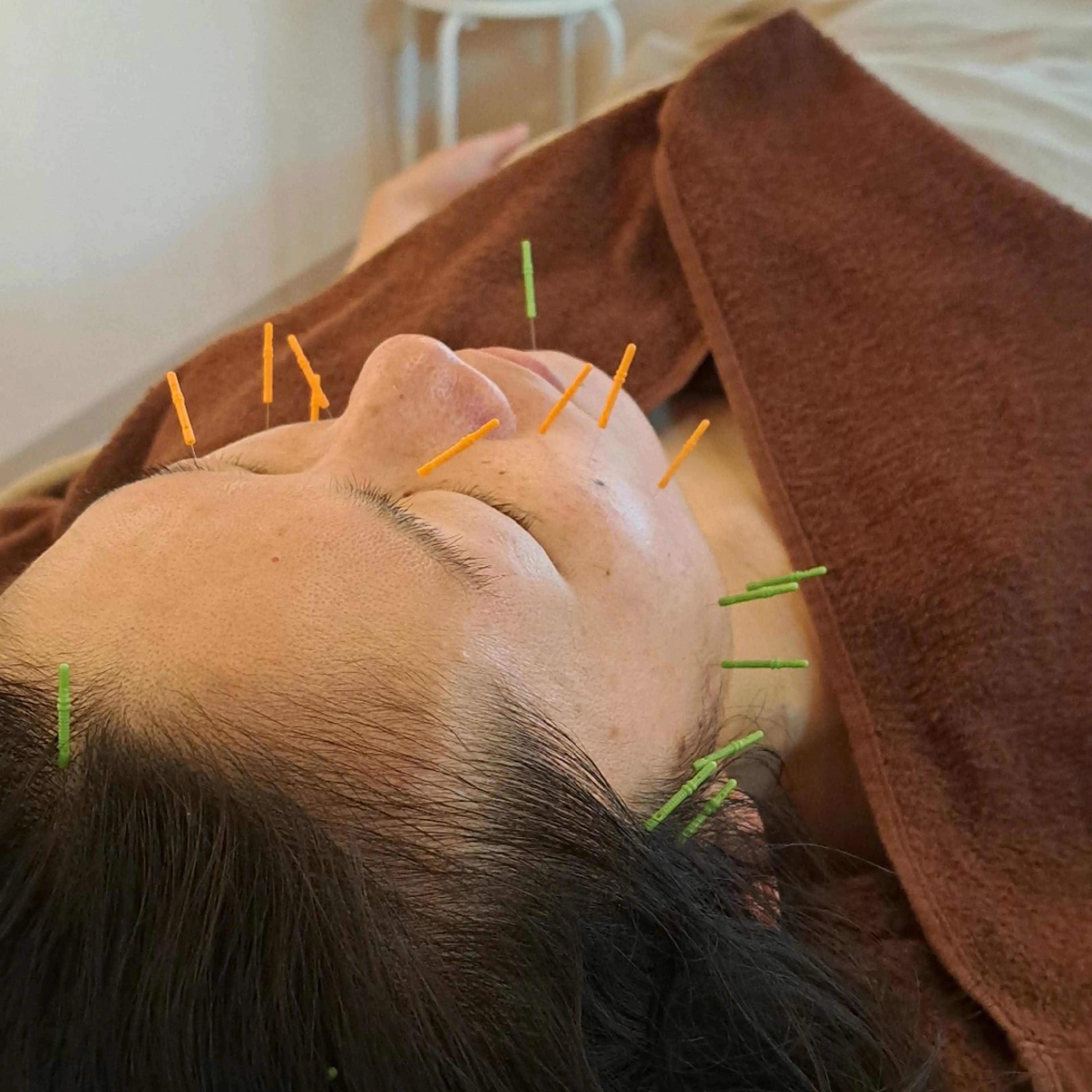 エステ リラク 鍼灸サロンmiyabi所属・美容鍼×エステ　鍼灸 サロンmiyabiのエステ・リラクイメージ