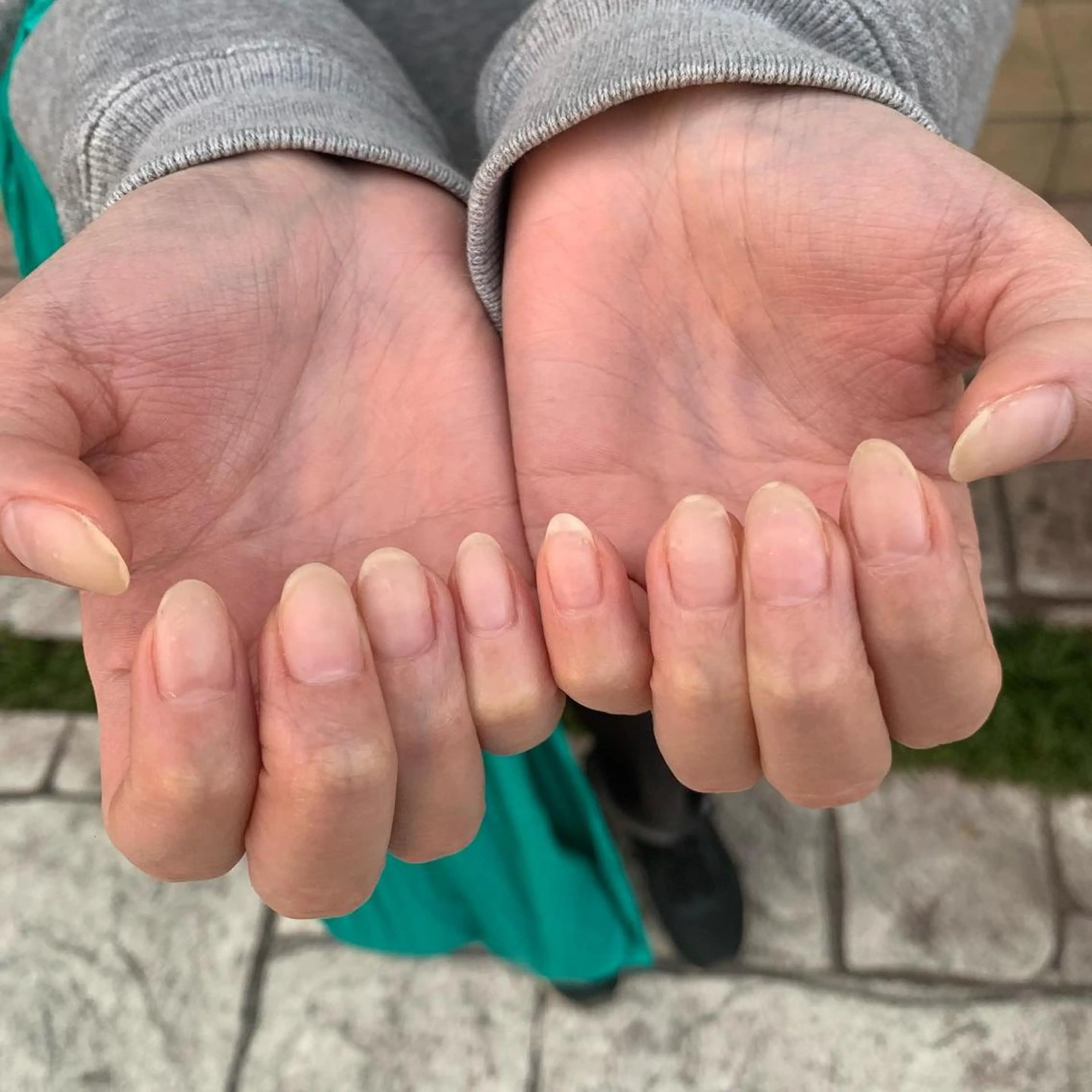 ジェルクリアの写真