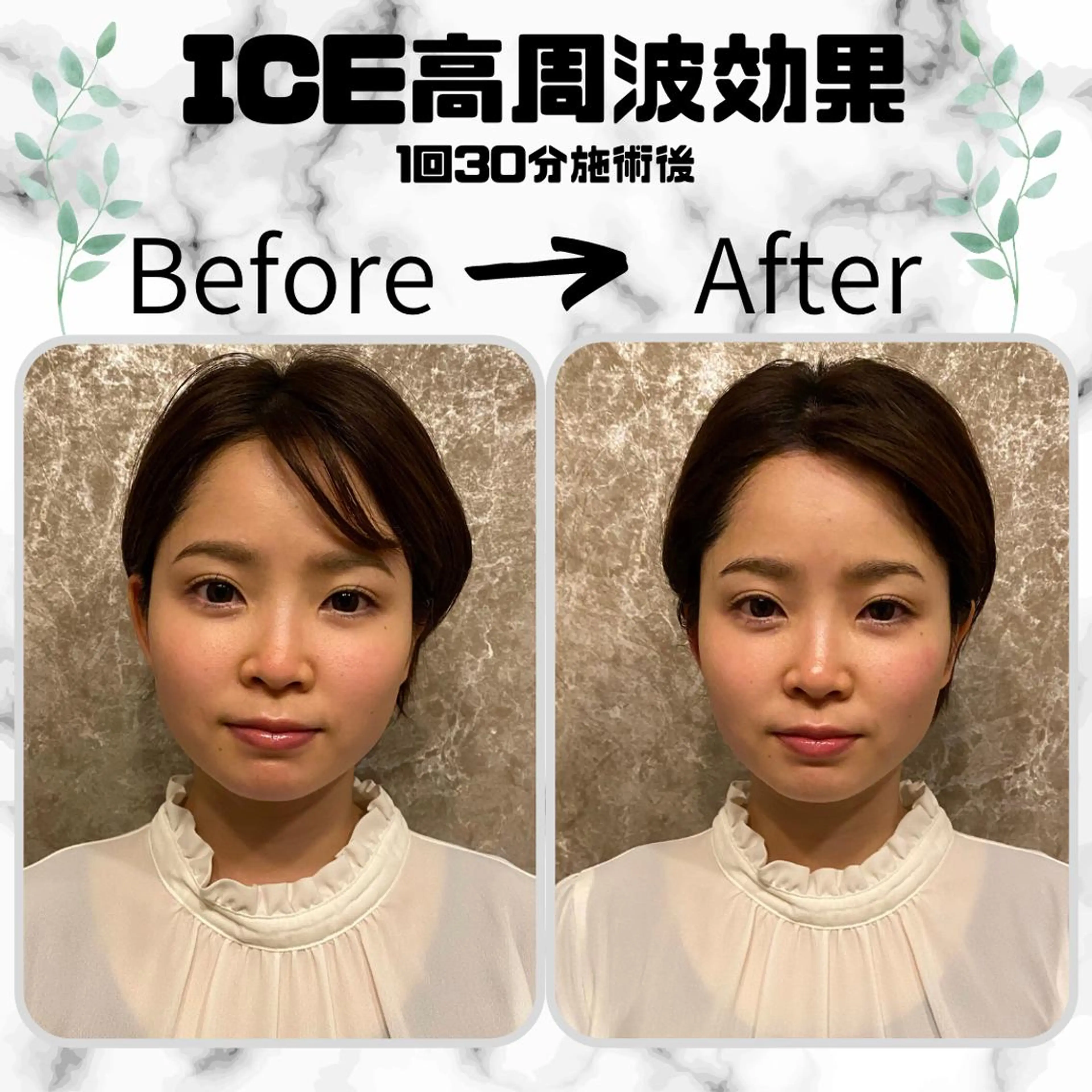 メンズ 男女同額完全個室脱毛 LEPIA内田のエステ・リラクイメージ