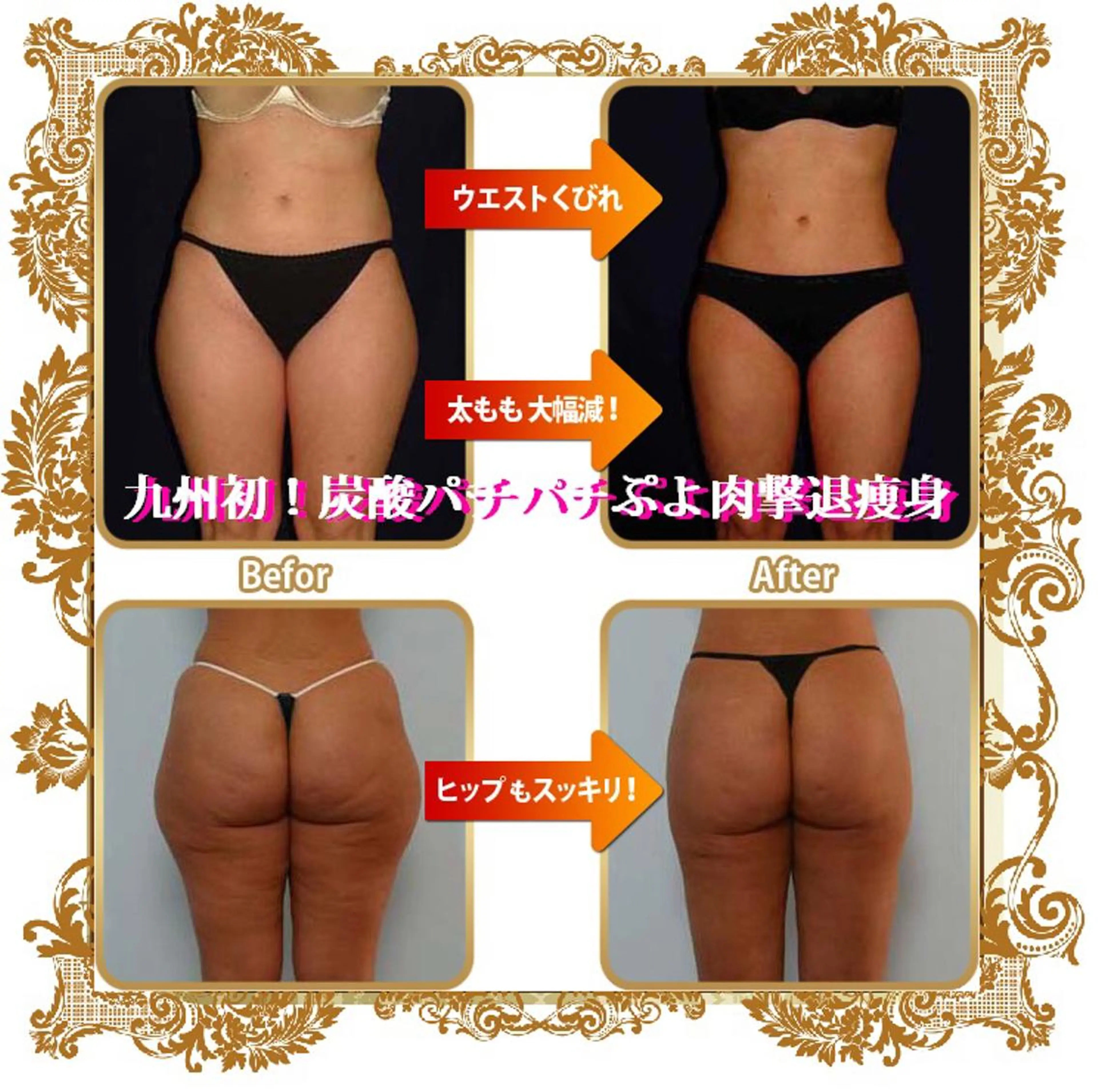 【ぷよ肉を撃退せよ！】オーダーメイドハンド痩身90分の写真