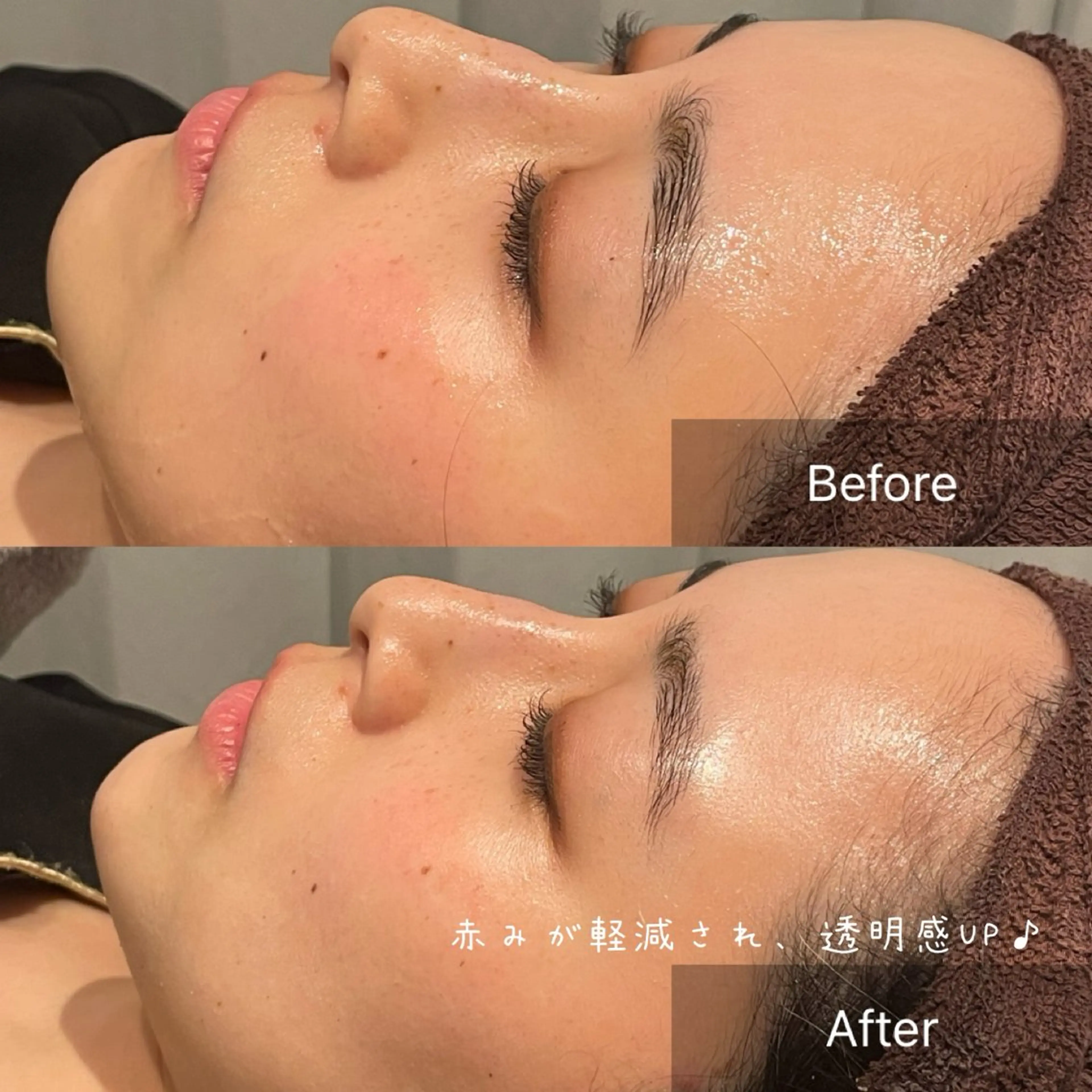 NA skin たまプラーザ　川島のエステ・リラクイメージ