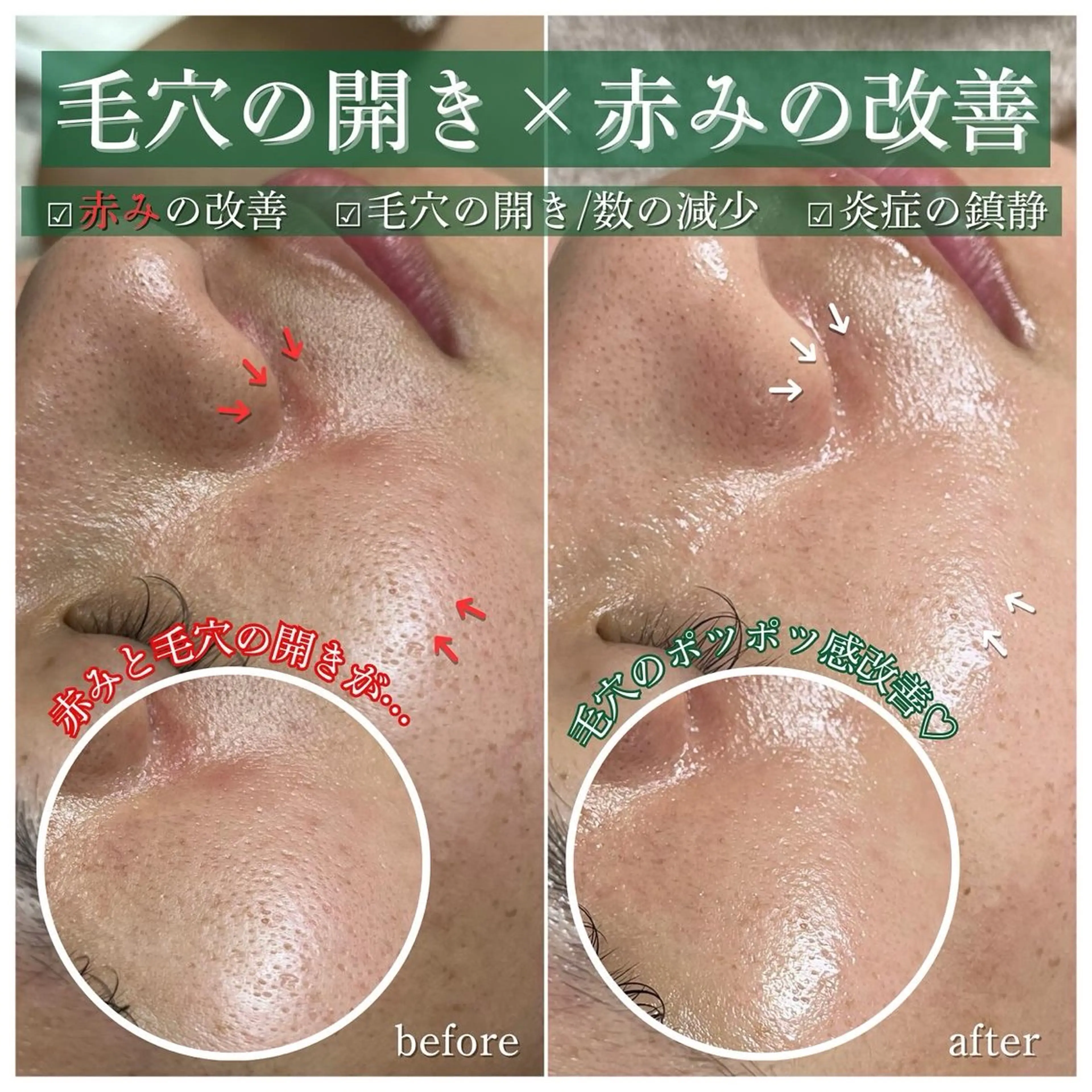 エステ リラク La Dusa 韓国肌管理/小波のエステ・リラクイメージ