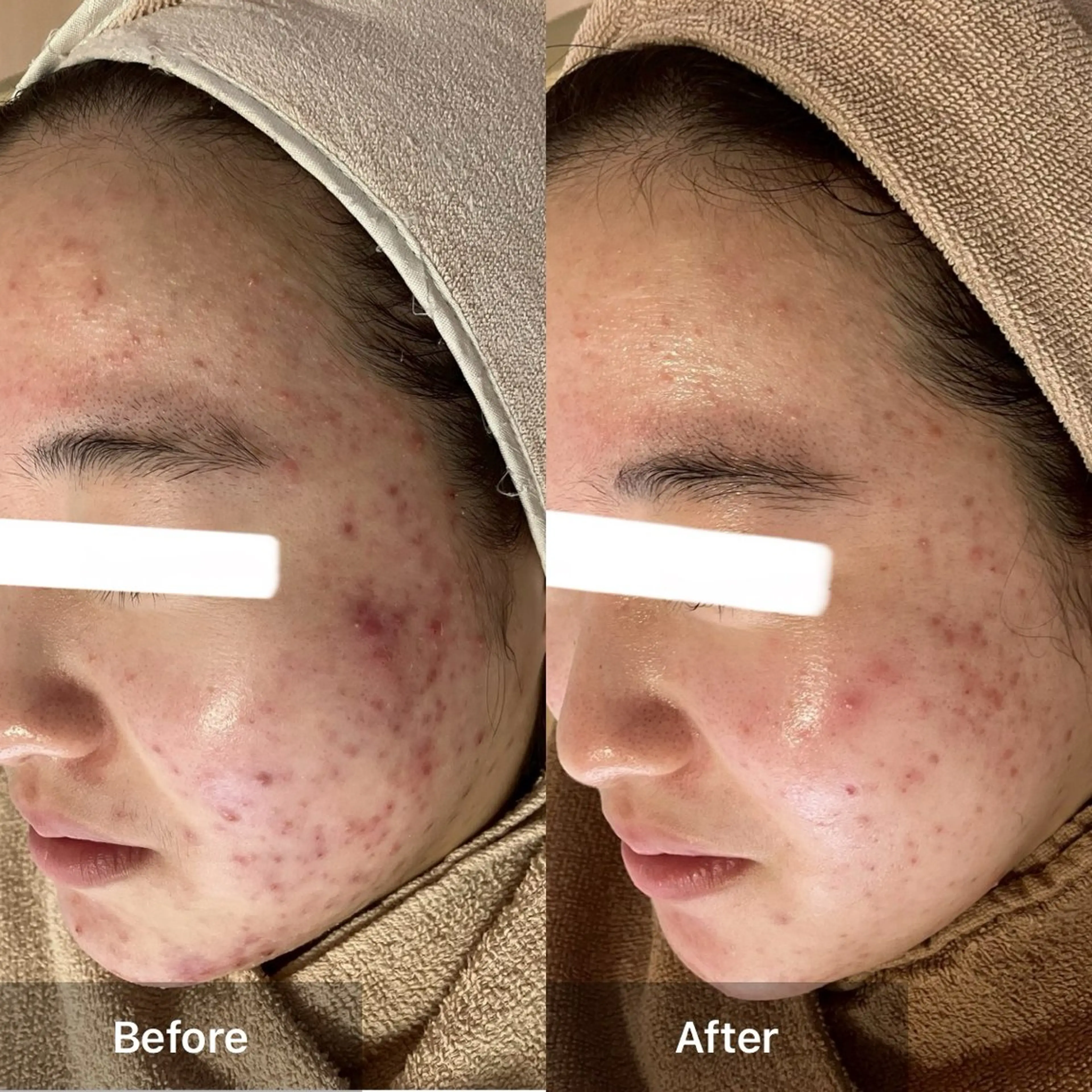 ハーブピーリング 専門店MOKA所属・ハーブピーリング専門 MOKAのエステ・リラクイメージ