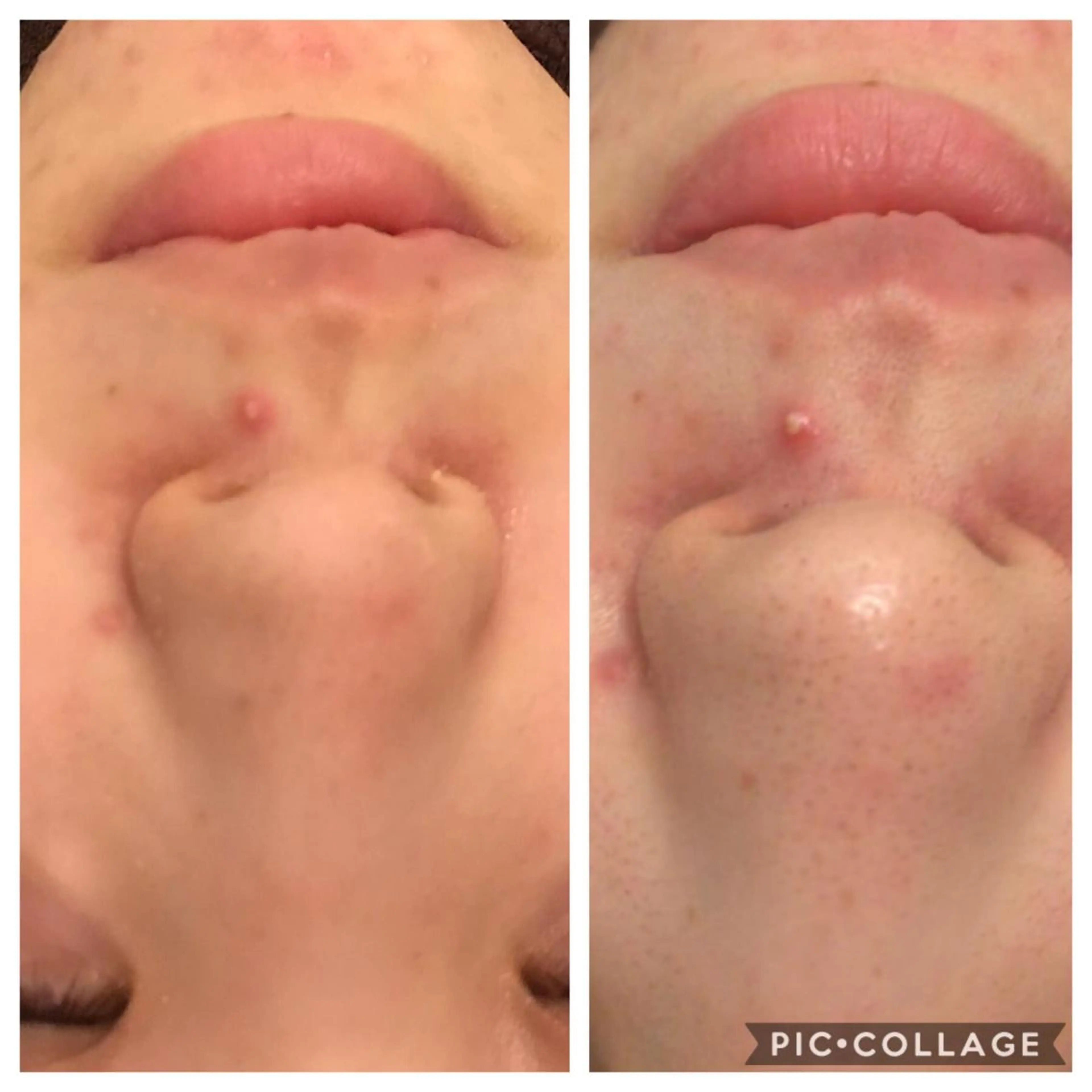 ミディアム カラー パーマ ヘアアレンジ メンズ キッズ ネイル マツエク・マツパ 四つ星サロン🎖 腸＆ニキビケアに特化のエステ・リラクイメージ