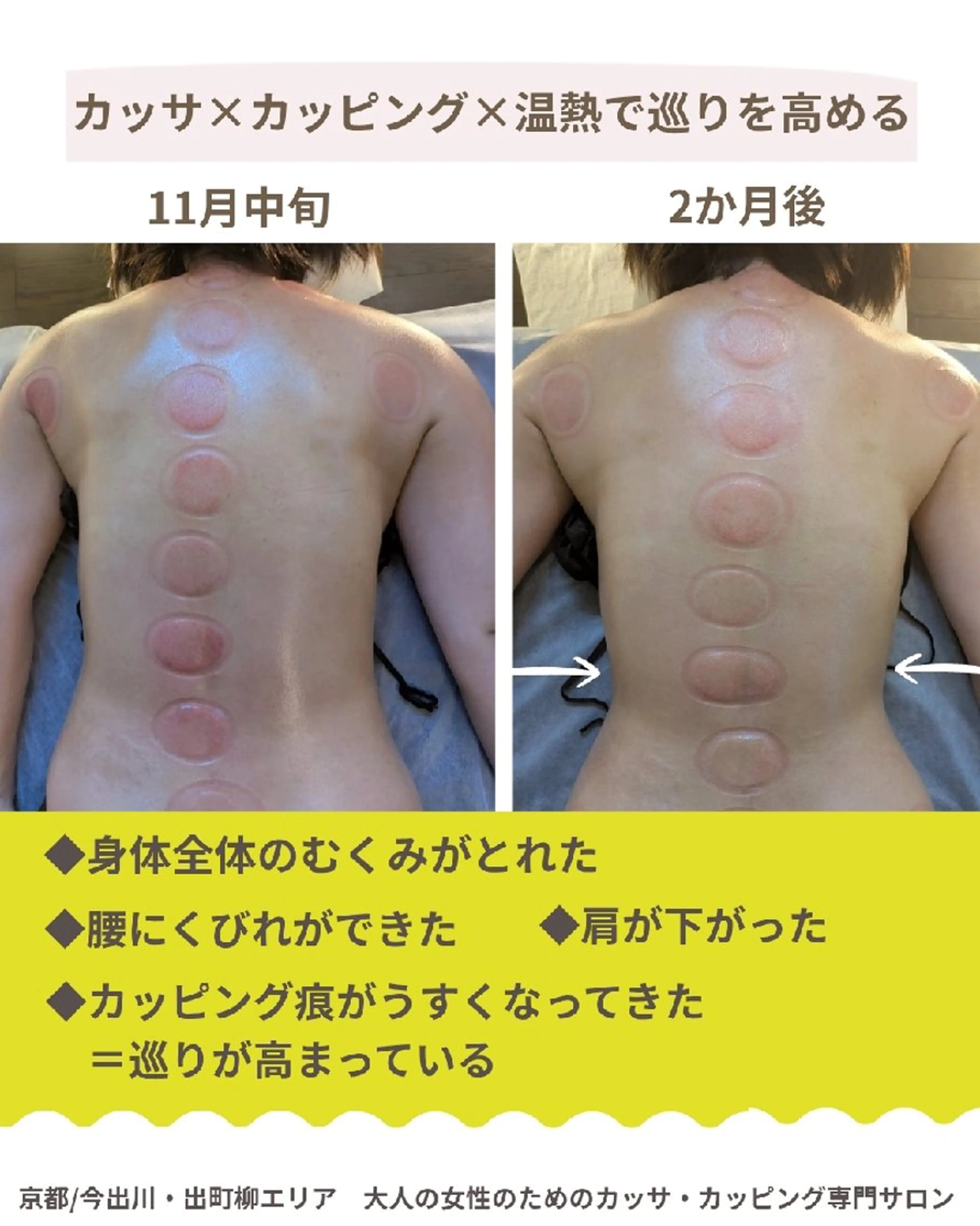 カッサ・カッピング専門サロン 水玉屋−suidamaya−所属・カッサ・カッピング 専門サロン/水玉屋のエステ・リラクイメージ