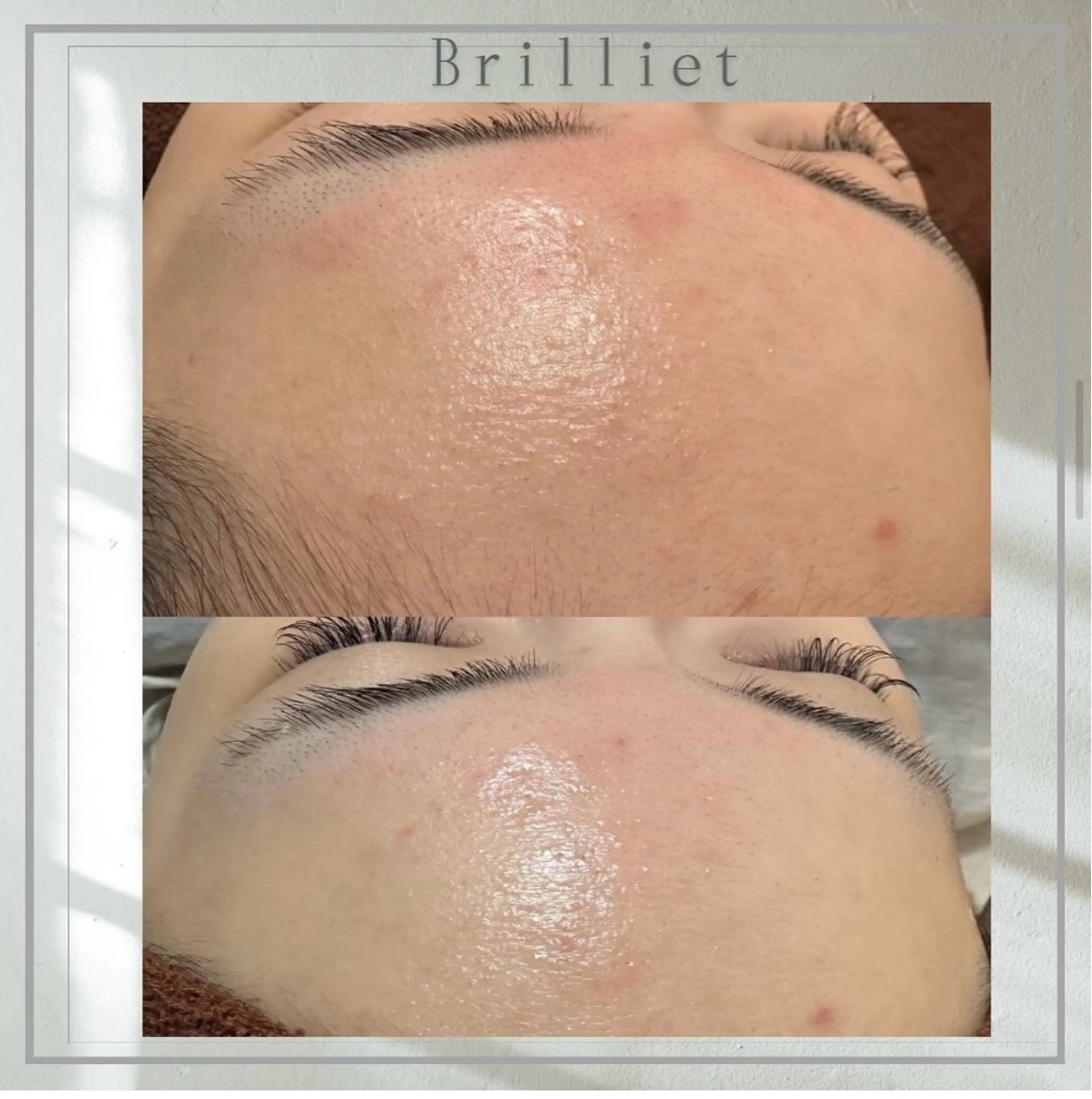 エステ 桐山 まどかのその他イメージ