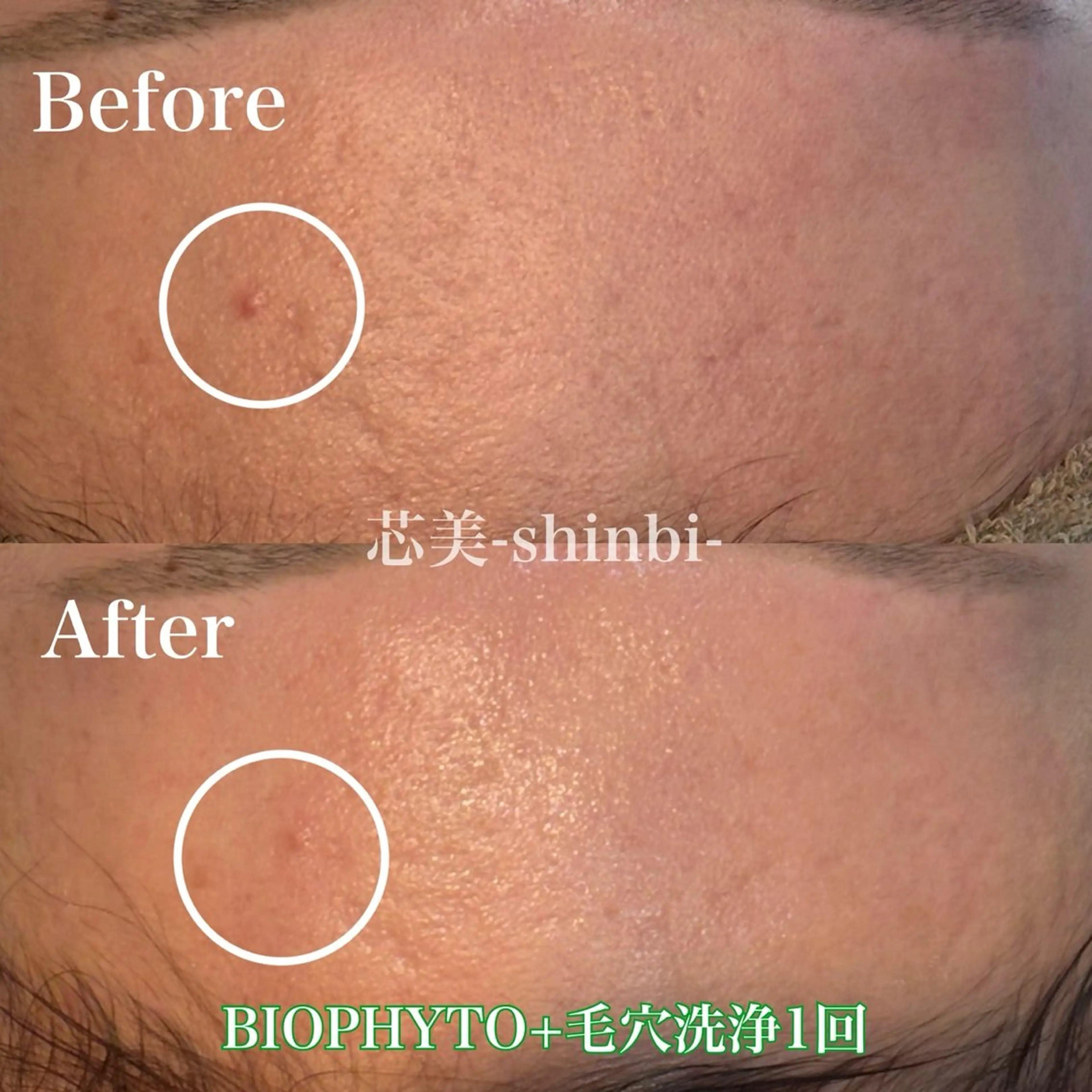 エステ 芯美-Shinbi- rinaのエステ・リラクイメージ