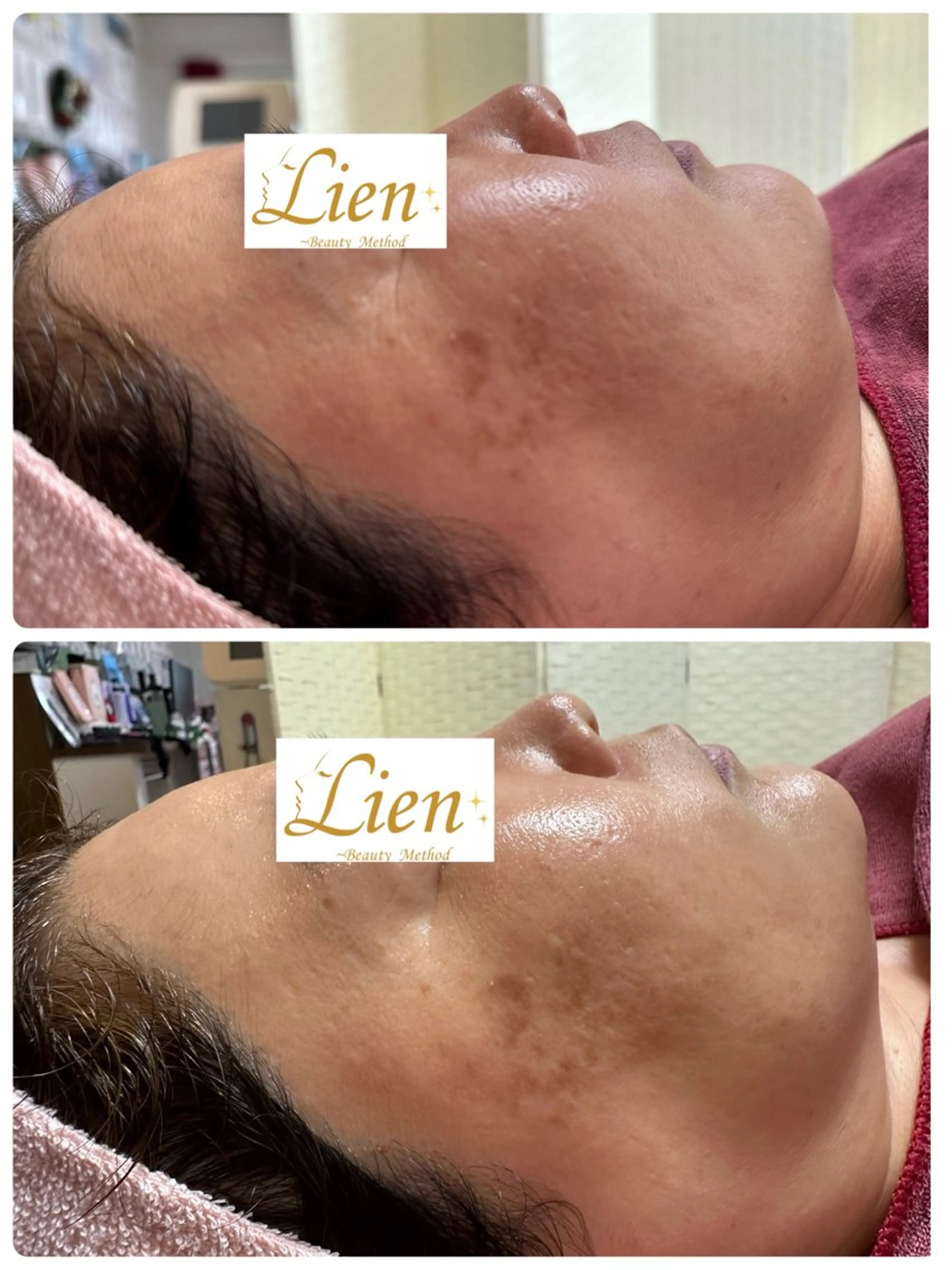 Lien オーナー　山口智嘉のエステ・リラクイメージ