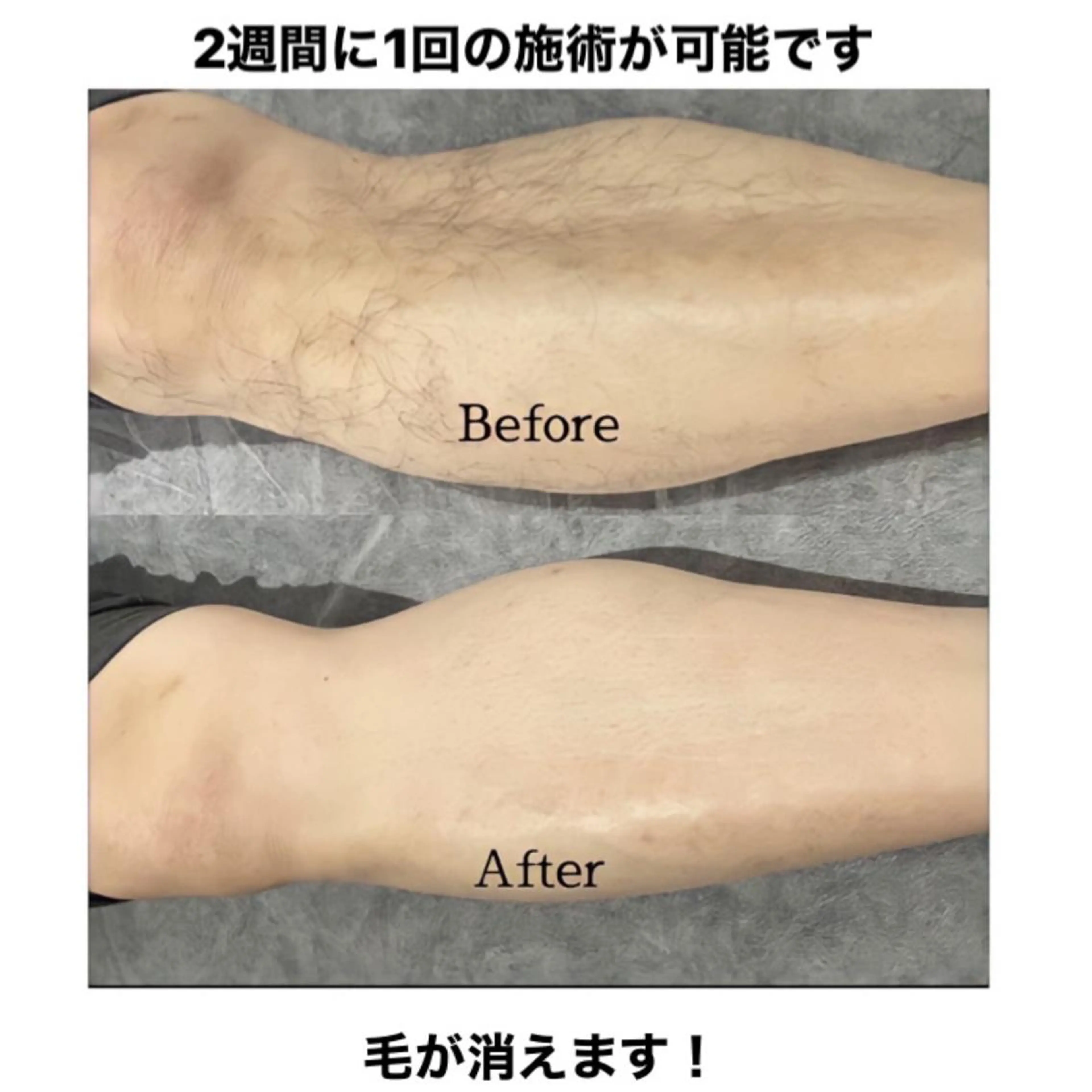 メンズ キッズ 脱毛 さろんどふじた甲子園所属・江嵜 真由美　　　　甲子園のマツエク・マツパデザイン