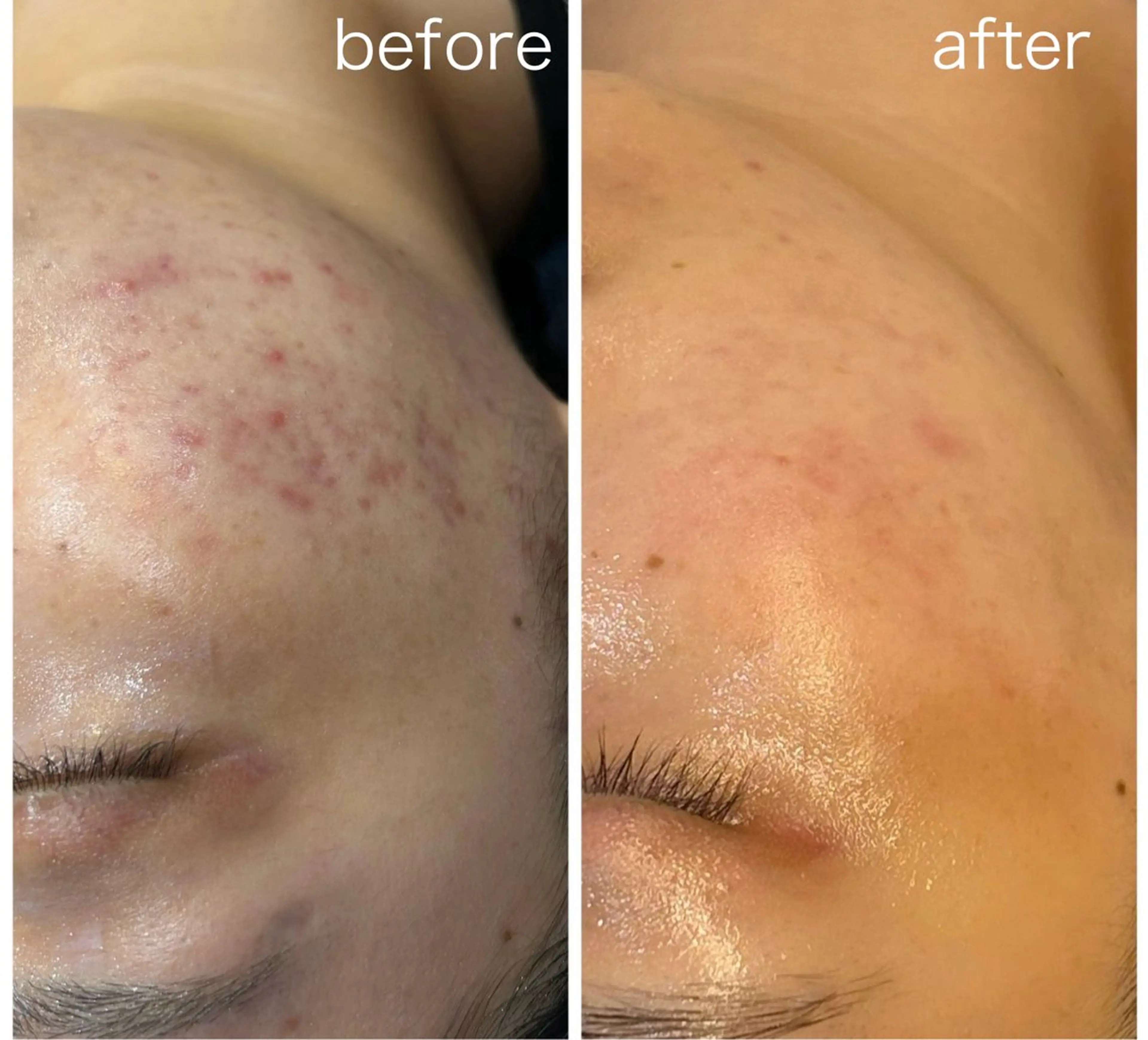 エステ leolo武蔵浦和 肌質改善＆脱毛のエステ・リラクイメージ