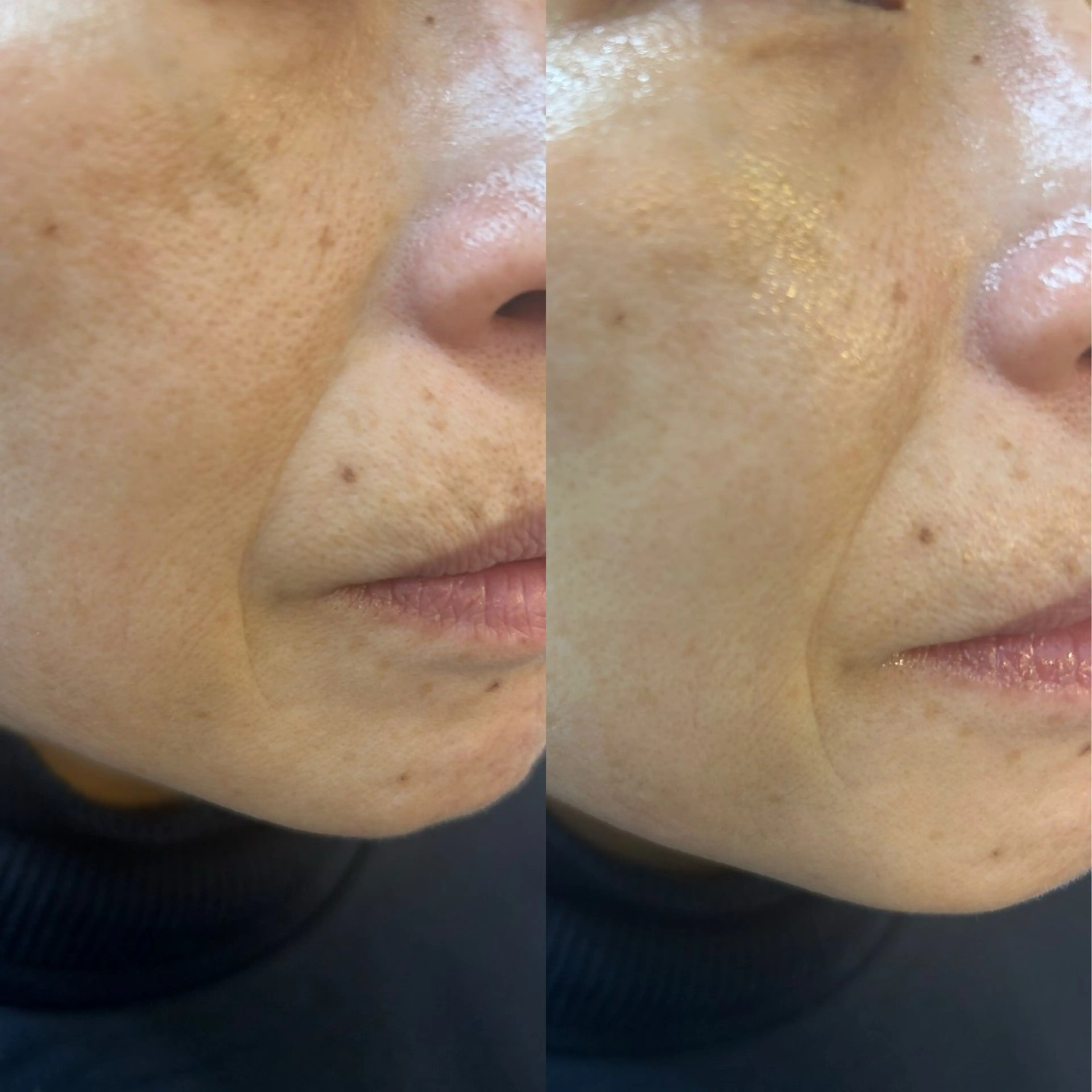 ナリスデアイム　　西宮所属・ナリス　デアイム西宮 辻　江梨那のエステ・リラクイメージ