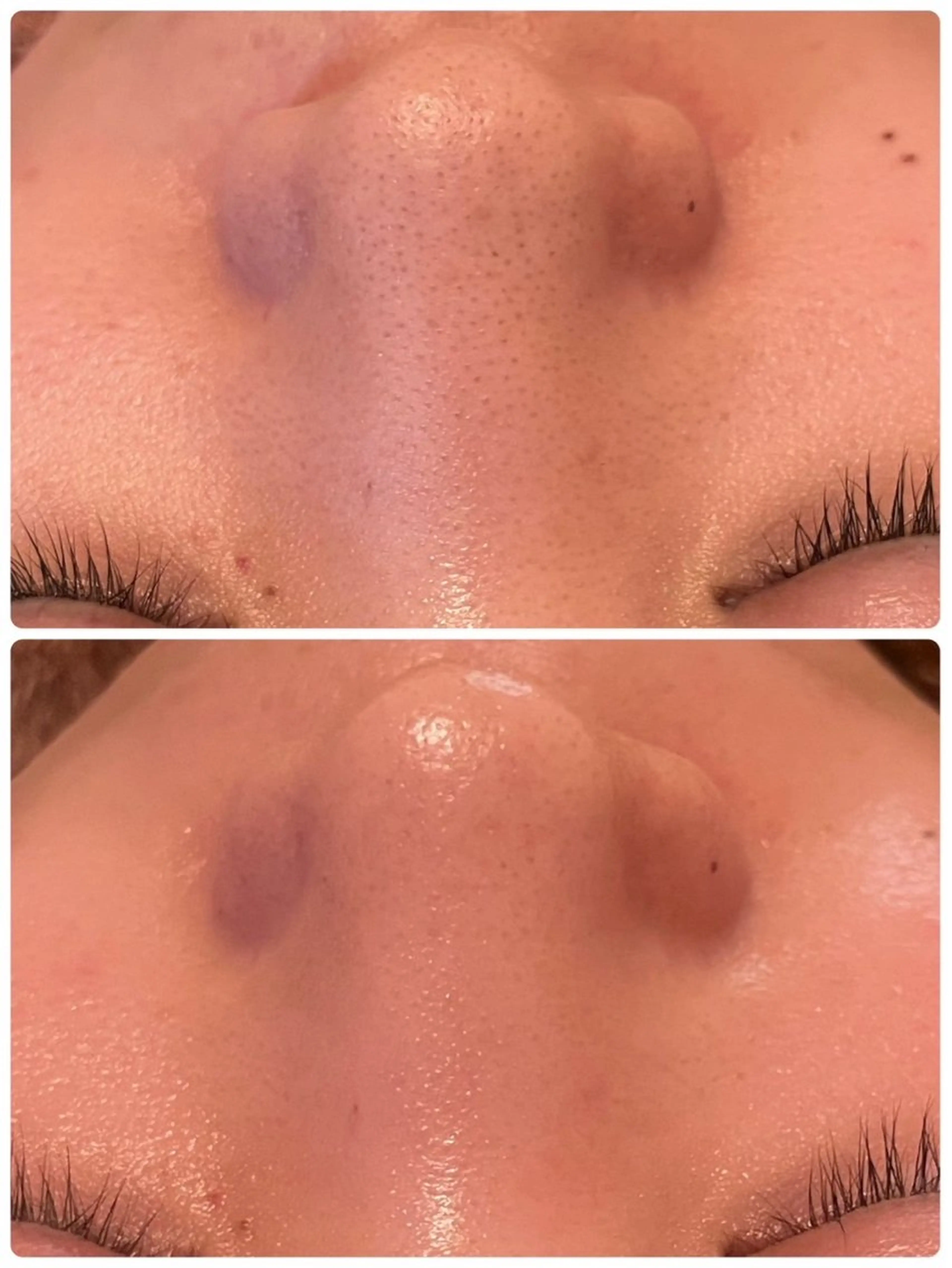 肌質改善サロン 来店プレゼントありのエステ・リラクイメージ