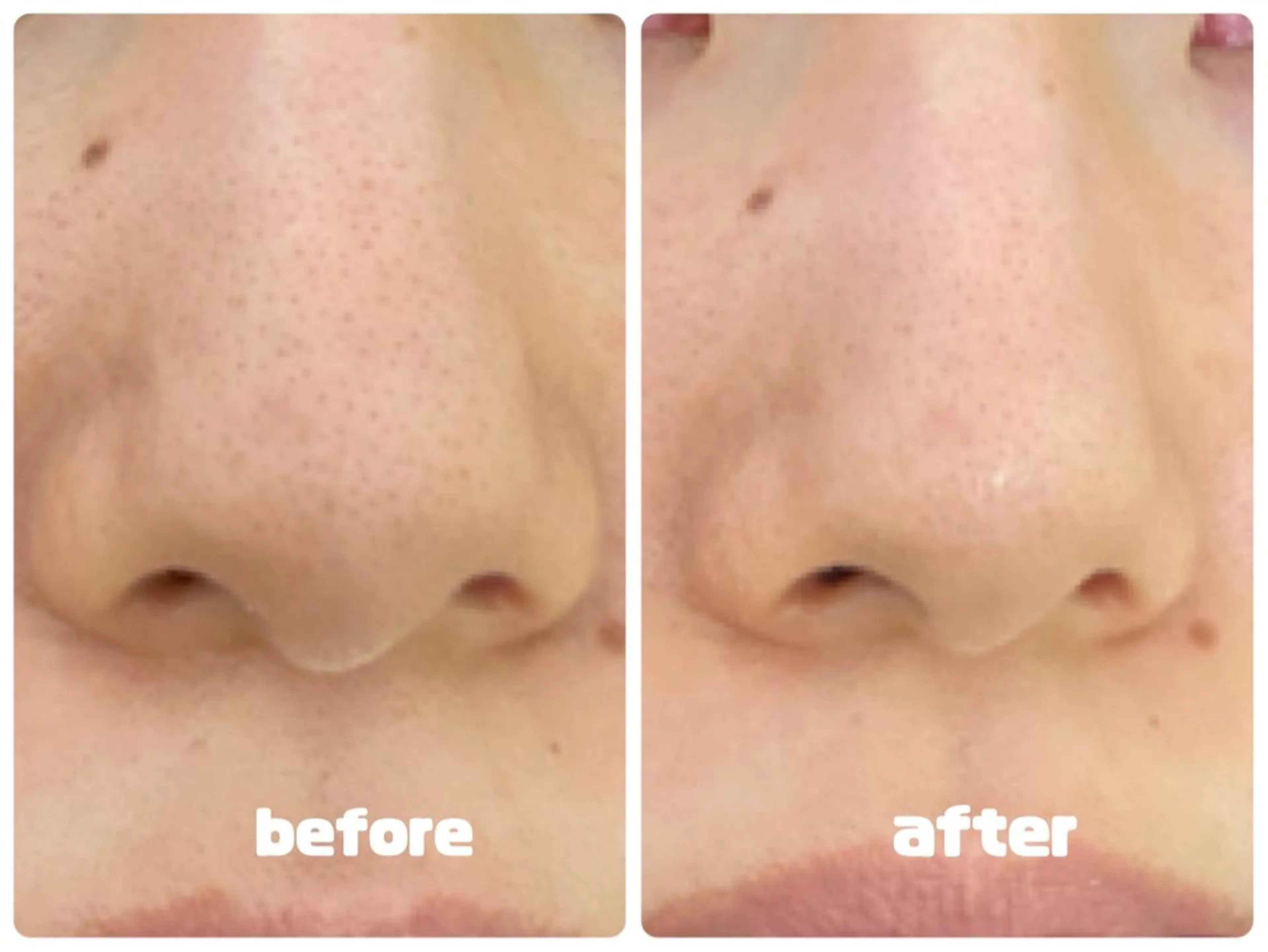 S beauteのマツエク・マツパデザイン