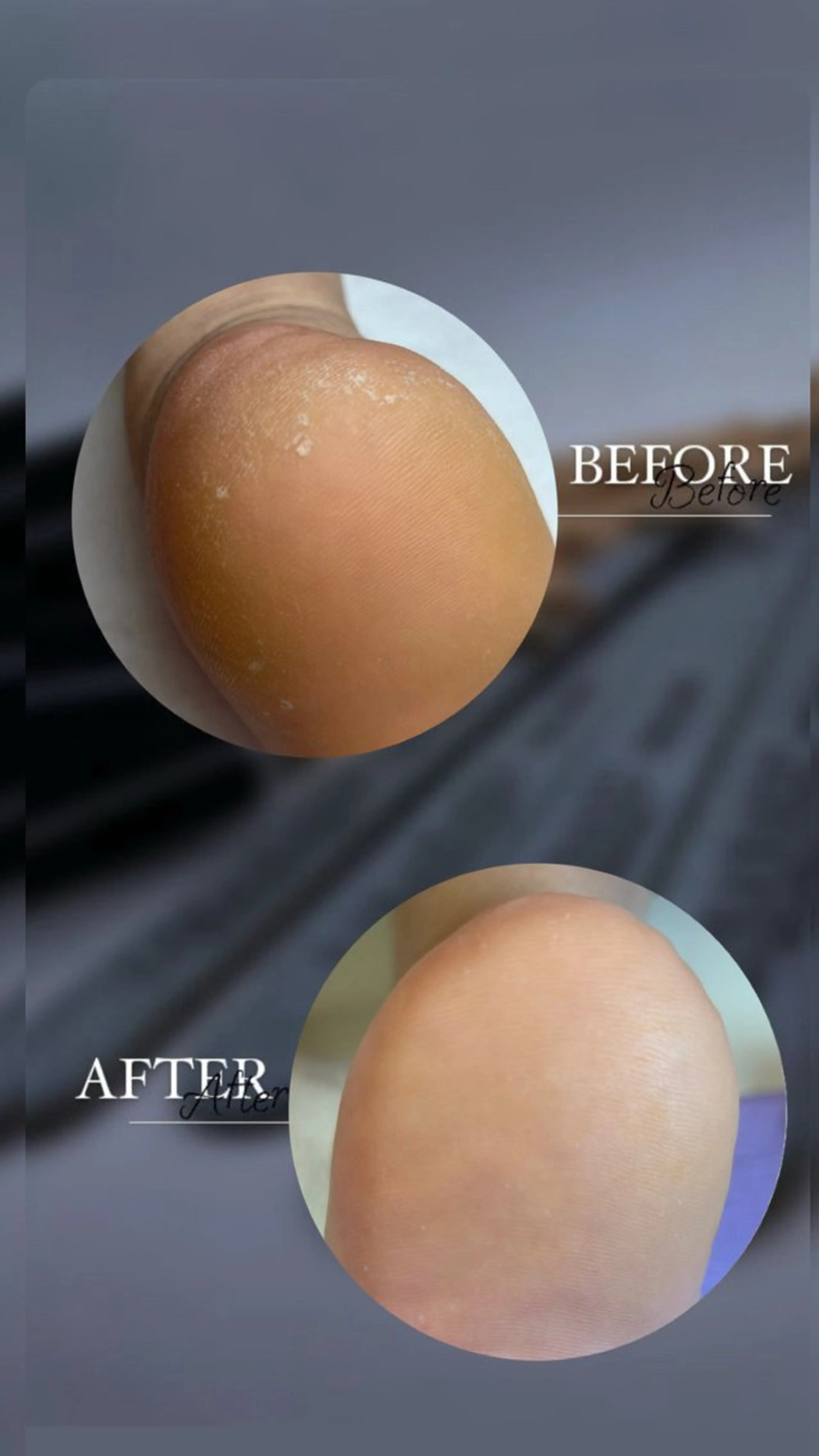 冬前にケアしよう！　かかとのひび割れやカサカサにお悩みの方ににオススメ。の写真