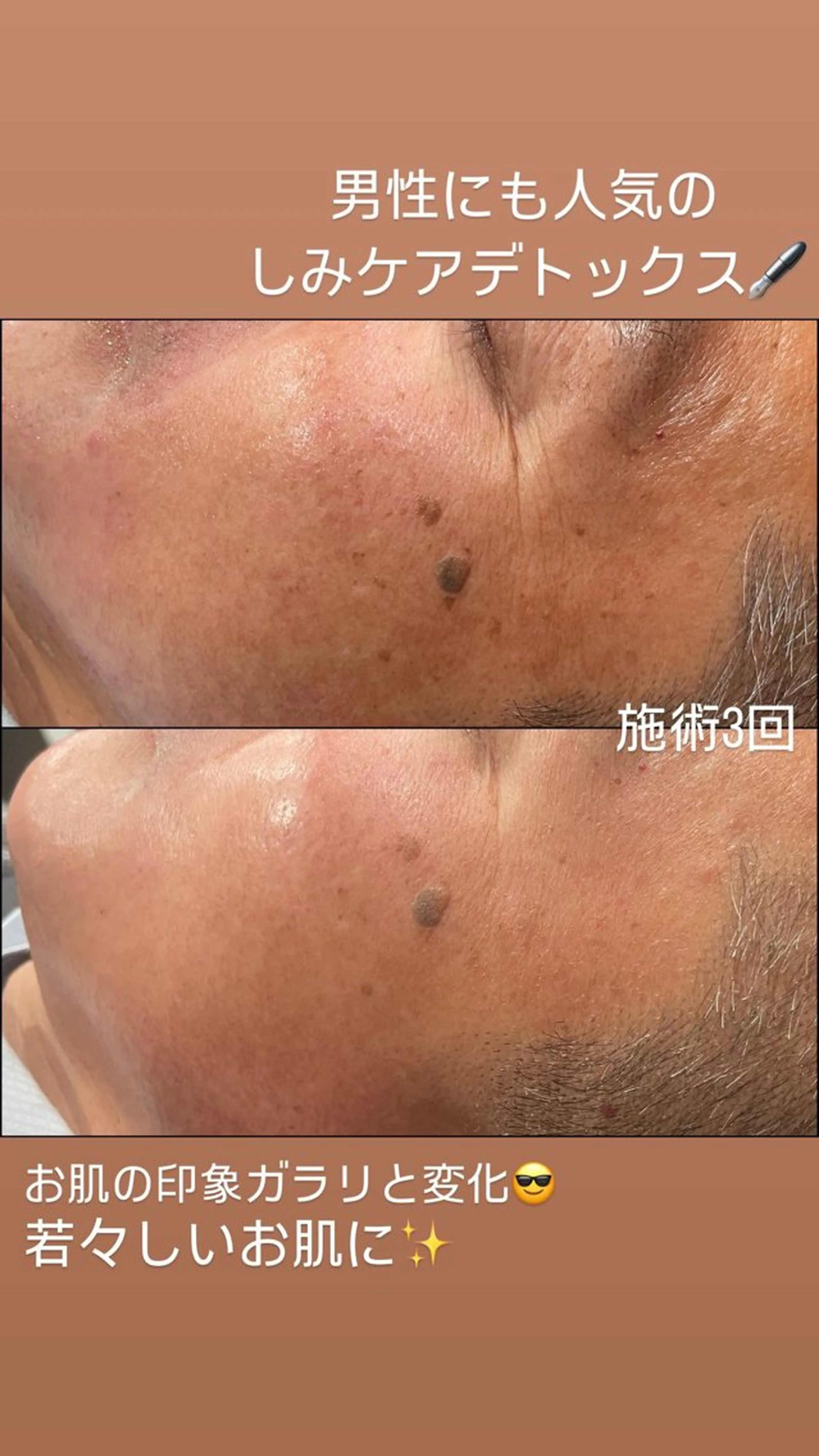 エステ LiZA エステティックサロンのエステ・リラクイメージ