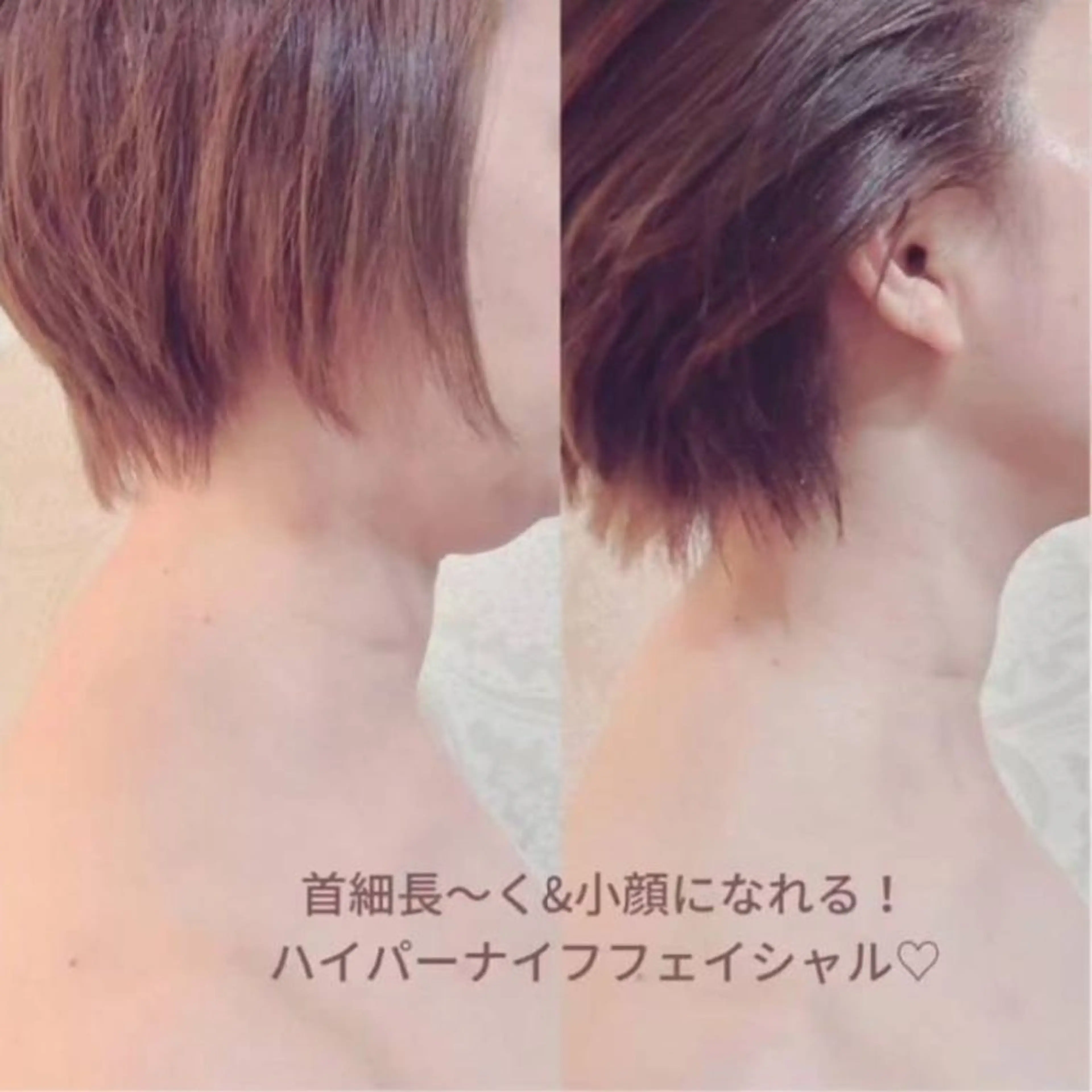 エステ ブライトサロン所属・☆ブライトサロン☆ 東瑞希のエステ・リラクイメージ