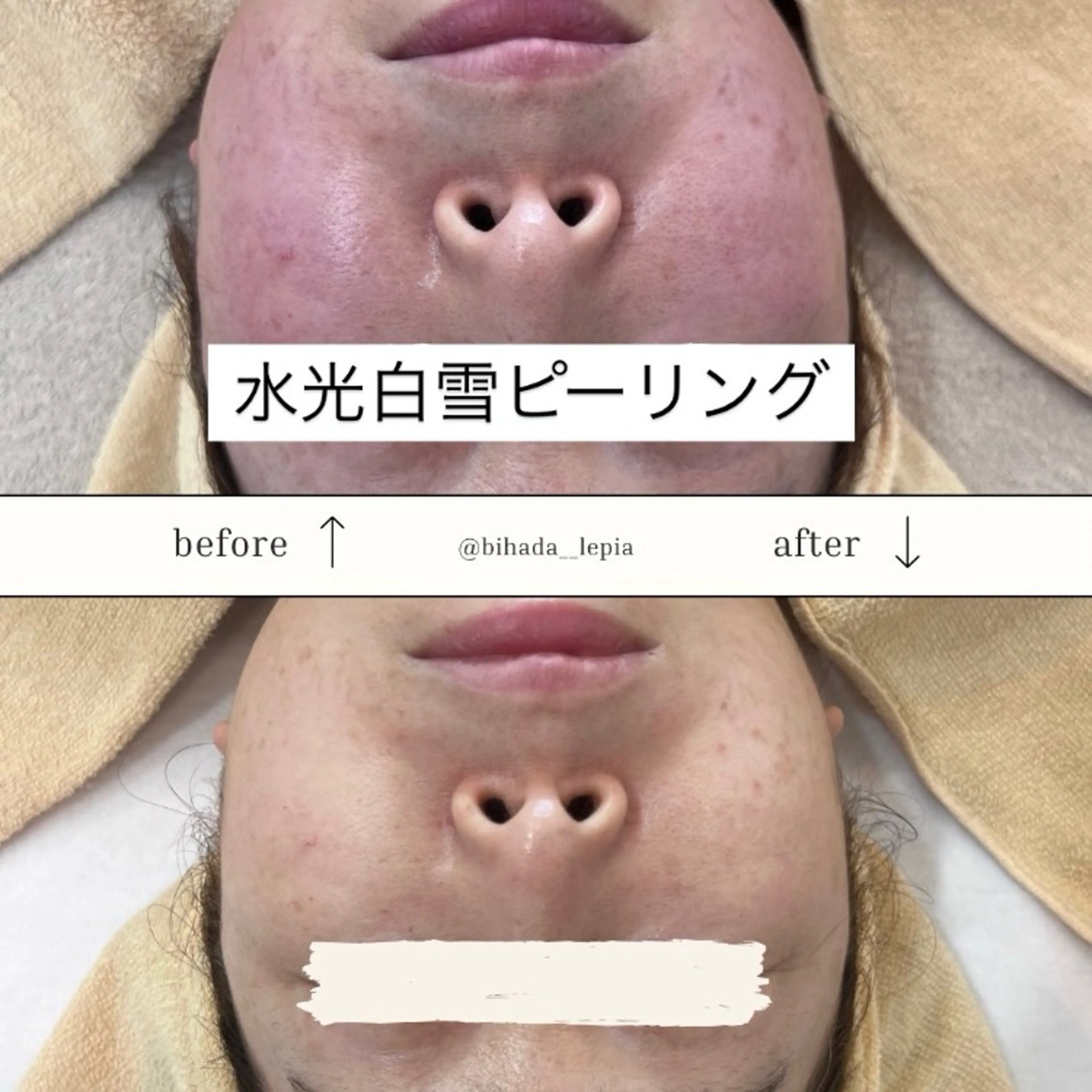 エステ リラク 肌質管理専門店 Lé pia　AMIのエステ・リラクイメージ