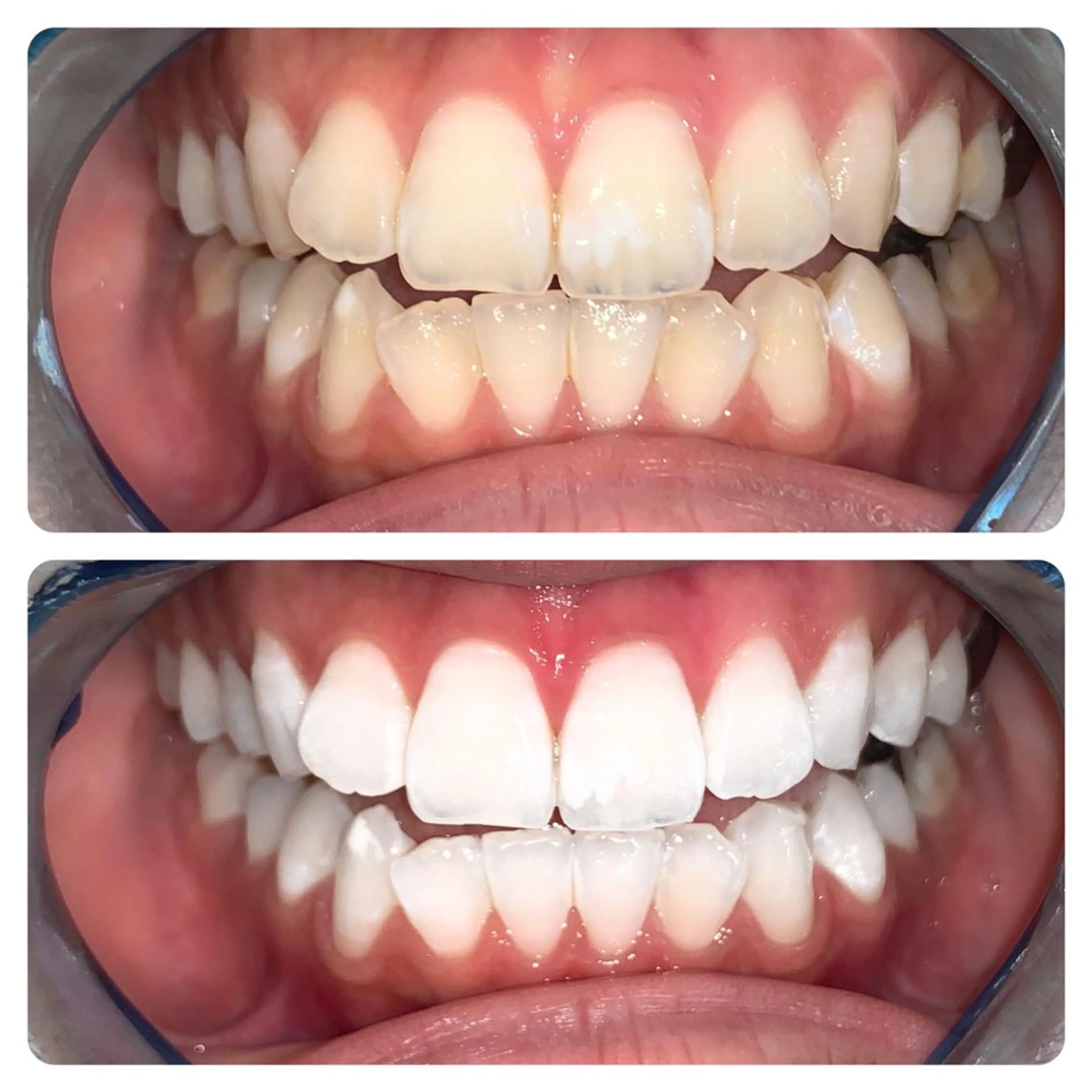 メンズ エステ リラク ライトビューティー 銀座店のエステ・リラクイメージ