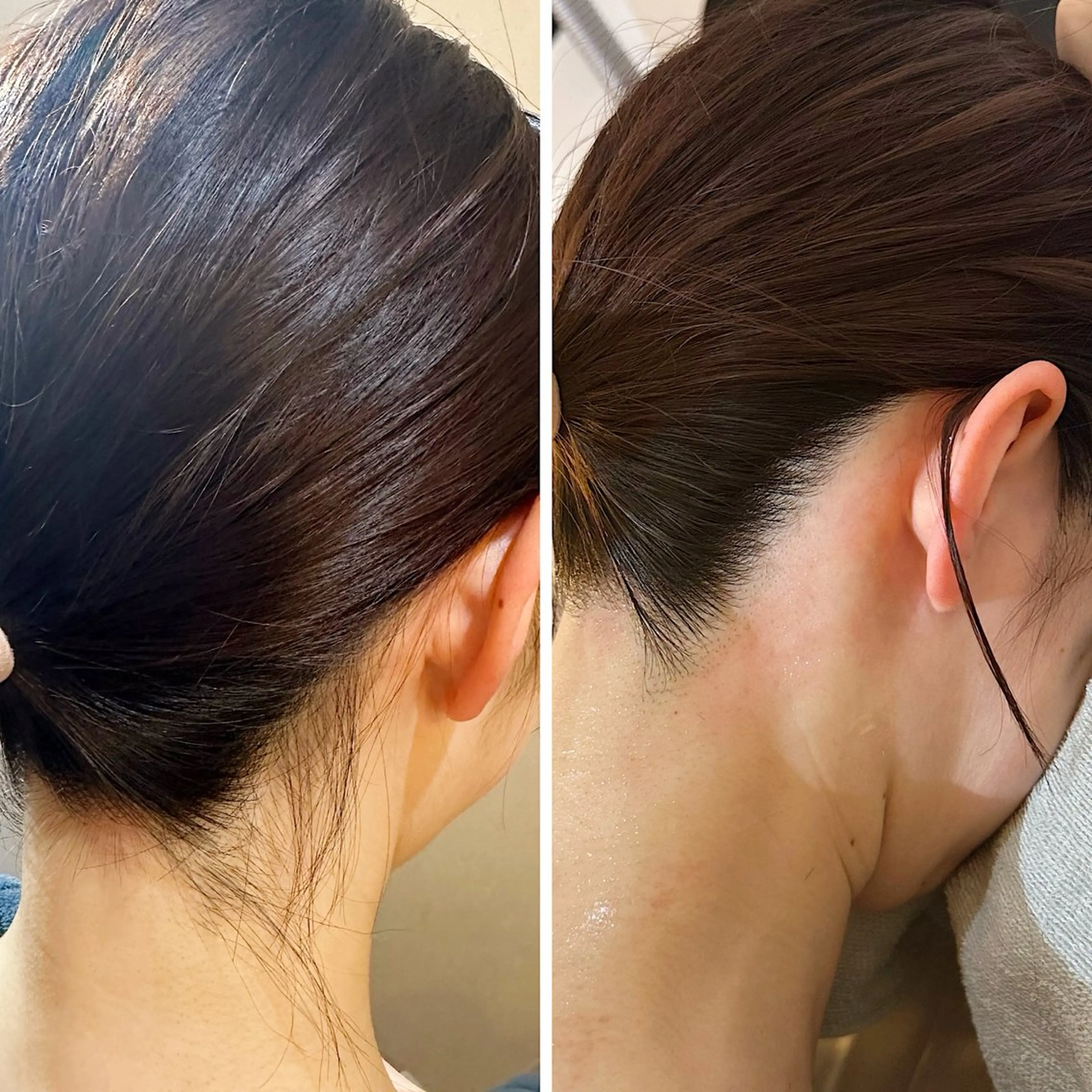 脱毛 うなじ脱毛/美肌脱毛 LABELのエステ・リラクイメージ