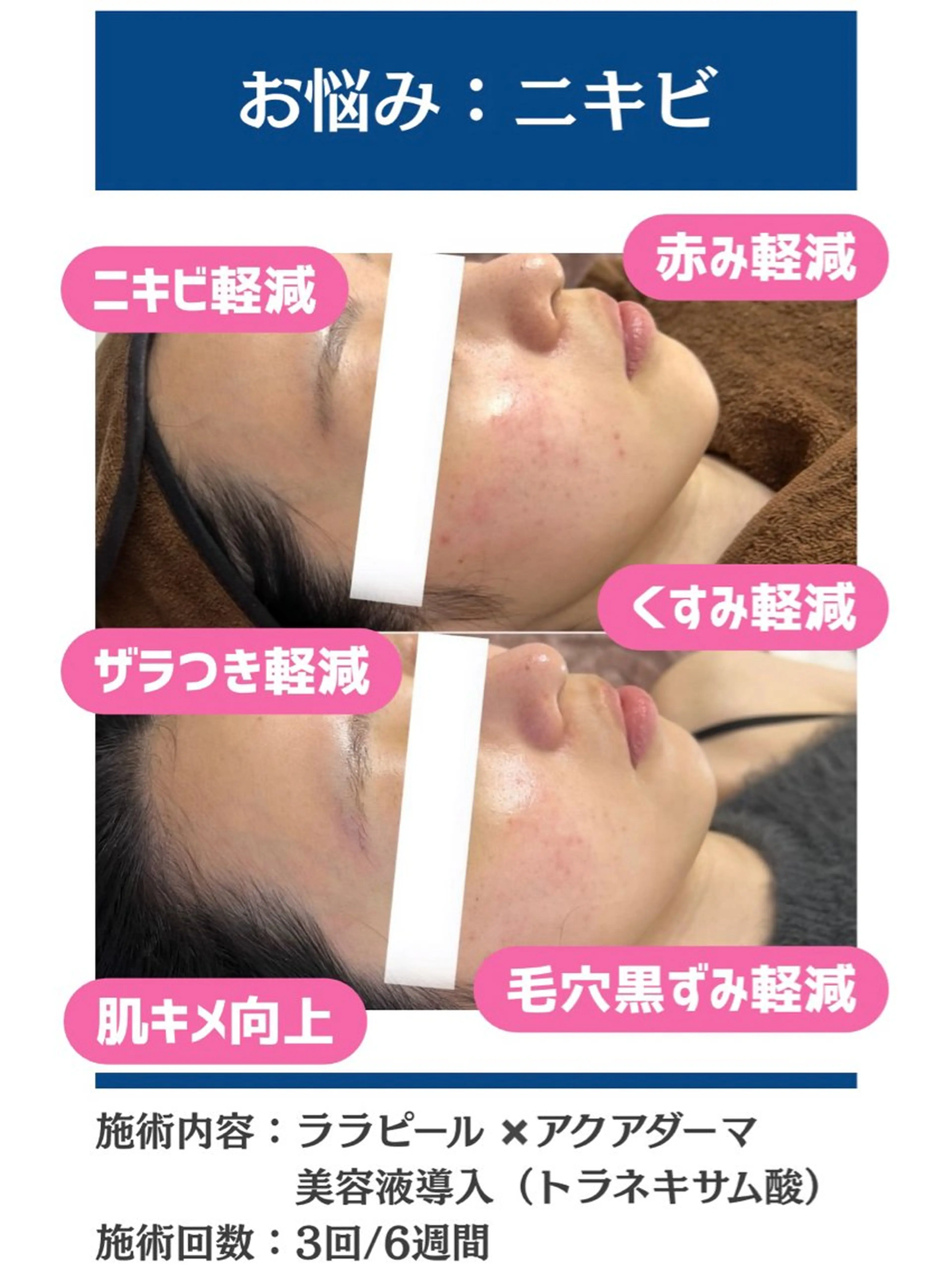 毛穴レス美肌へ🌿 看護師Abe🌼のエステ・リラクイメージ