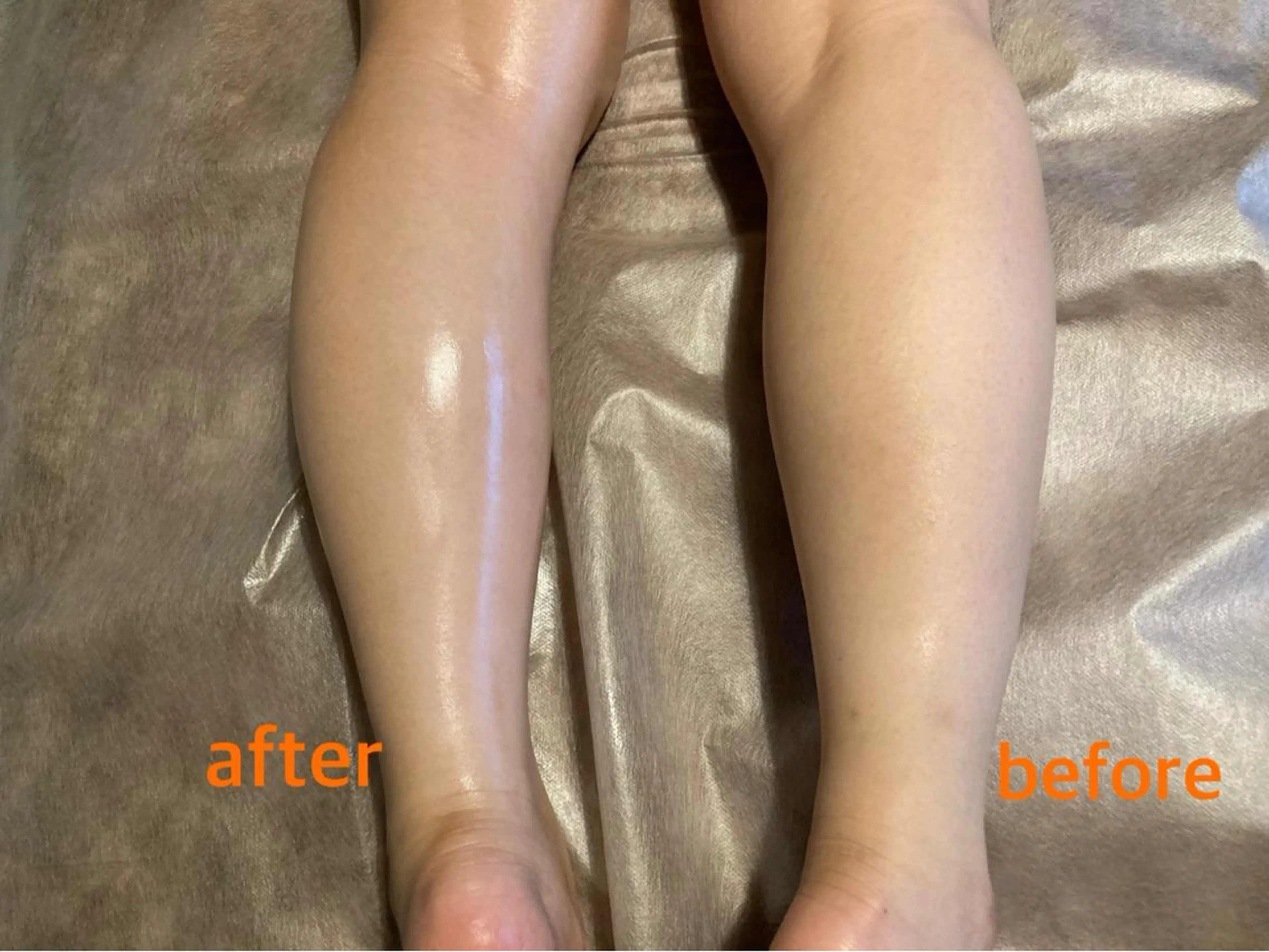 bellissimo 【ベリッシモ】所属・ちひろ　痩身/ハーブ bellissimoのエステ・リラクイメージ