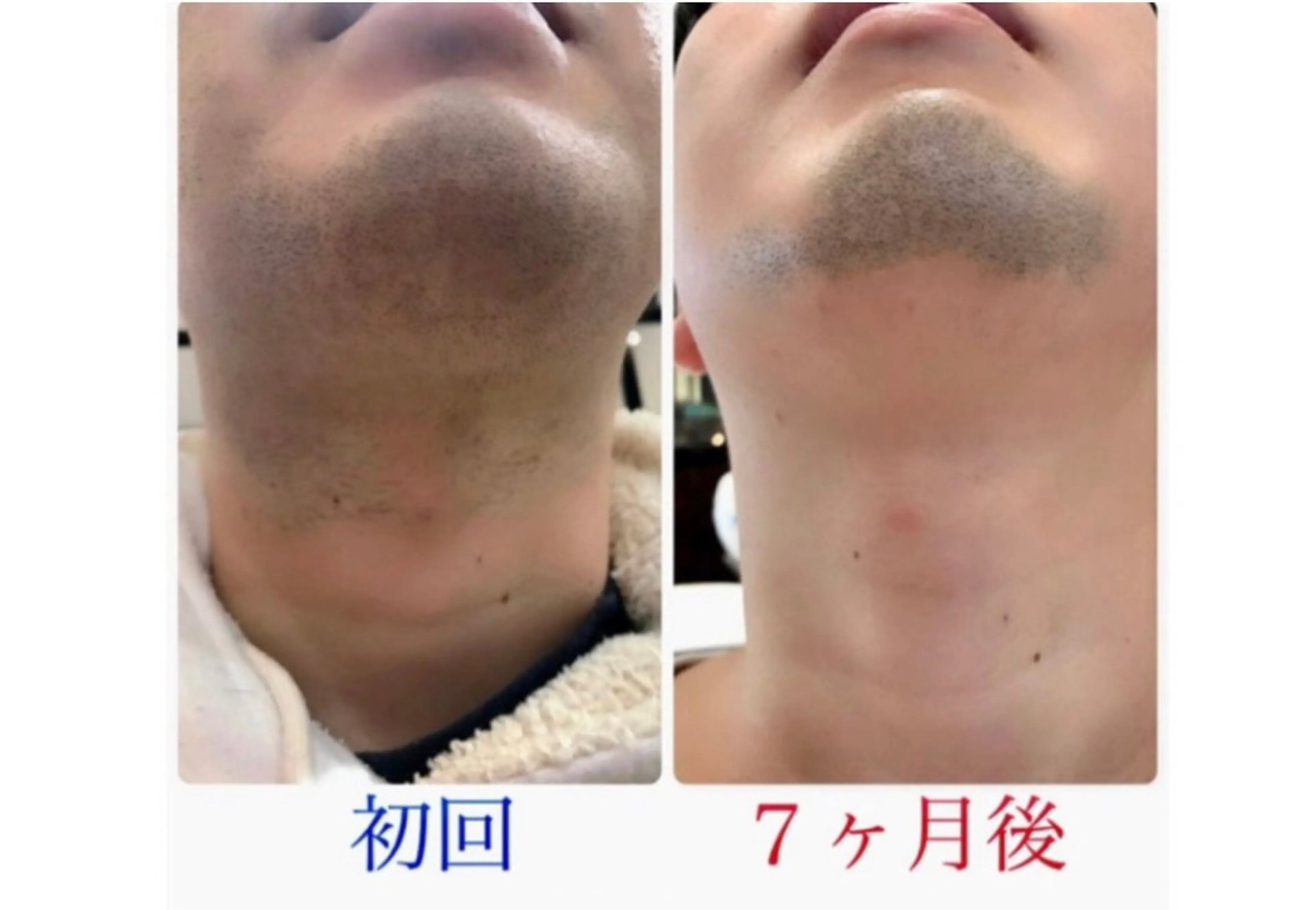 脱毛 RAY Beauty エステ　一宮店のエステ・リラクイメージ