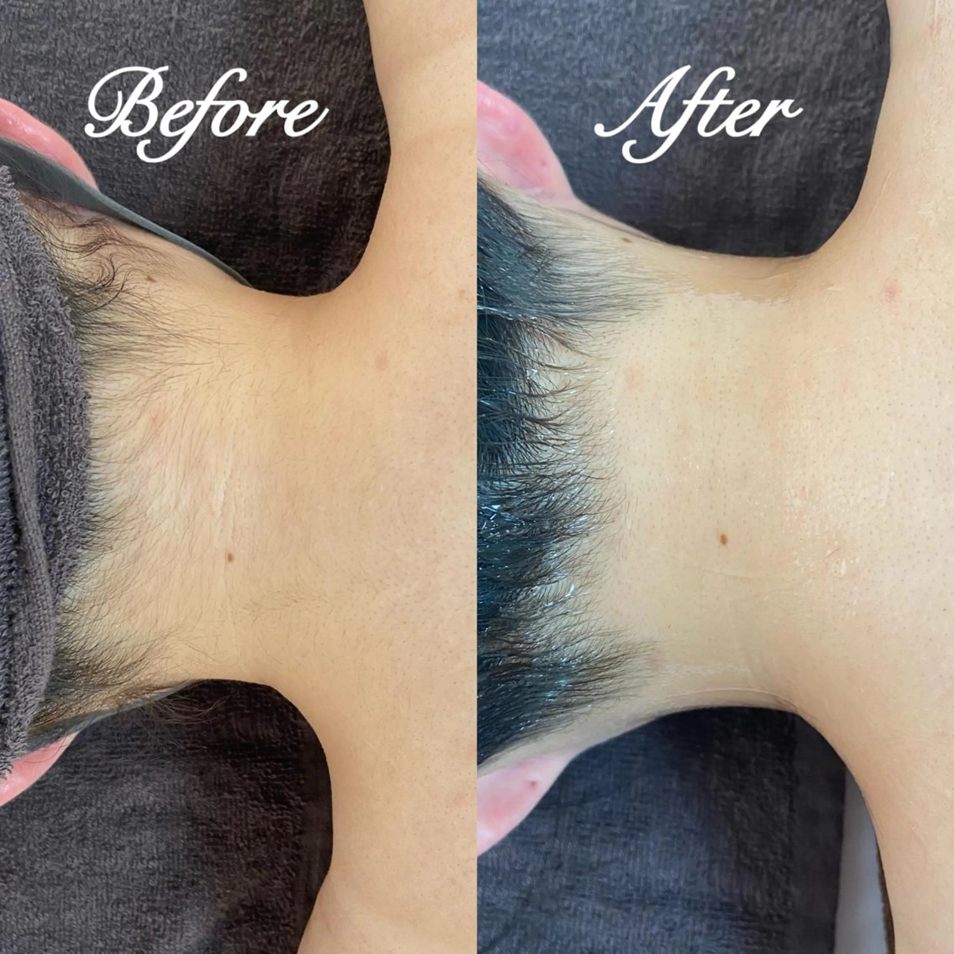 都度払い制脱毛サロンBe Charm所属・Be Charm 山﨑のエステ・リラクイメージ