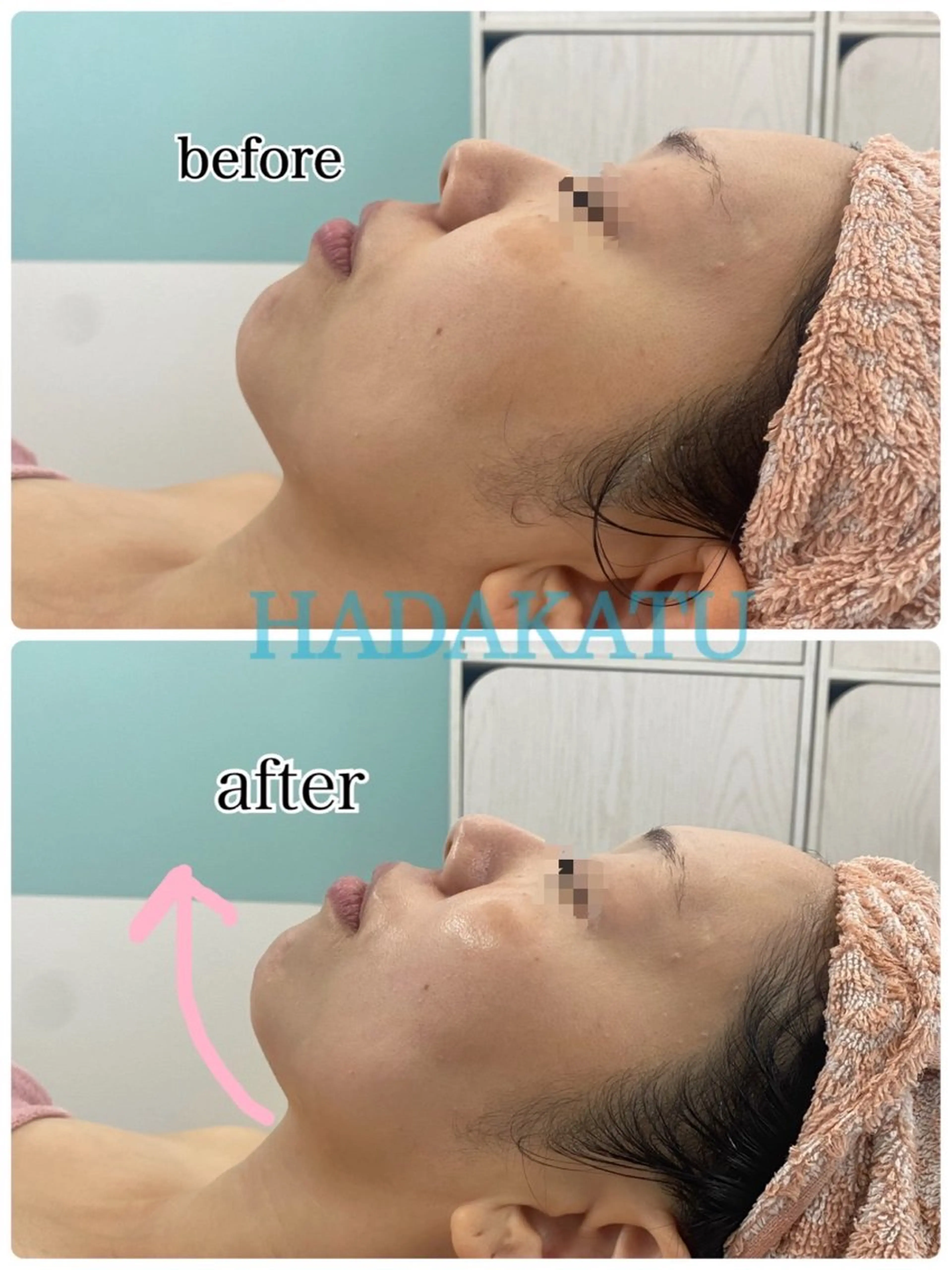 エステ 総合エステサロン 肌活のエステ・リラクイメージ