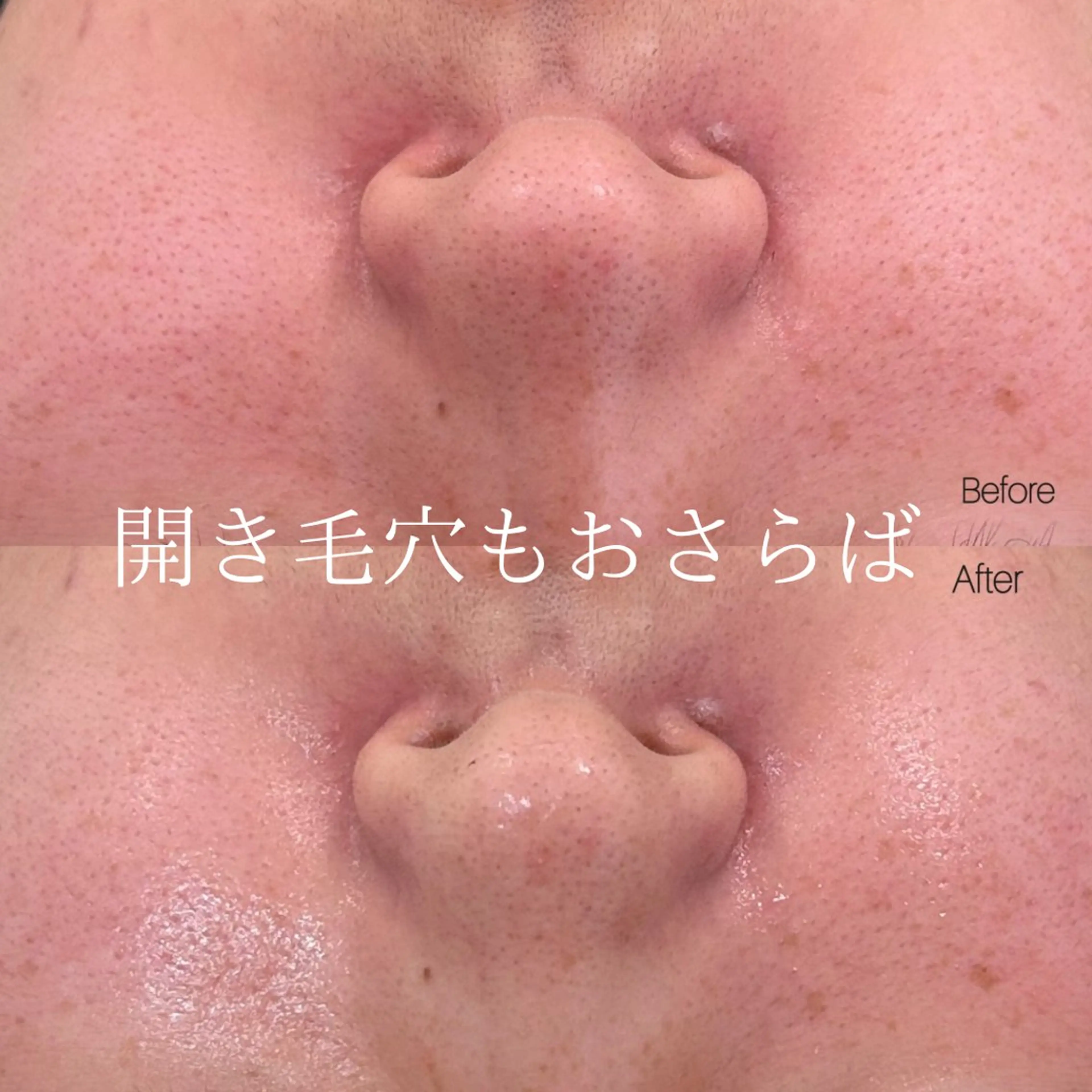 エステ 〈etre〉トータルビューティーサロン所属・etre - 韓国肌管理 -のエステ・リラクイメージ