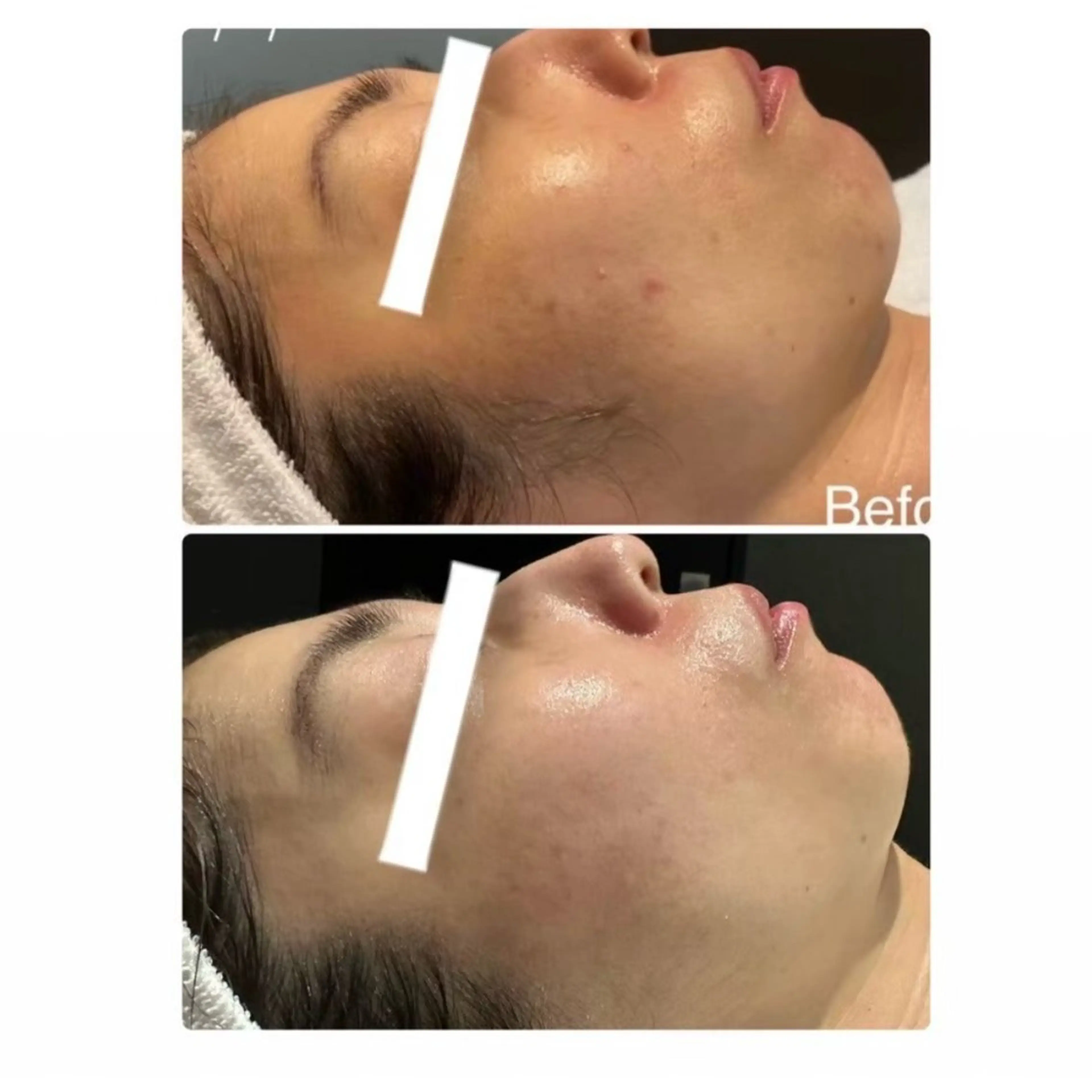 デ・アイム心斎橋所属・肌質改善サロン🫧 MAIのエステ・リラクイメージ