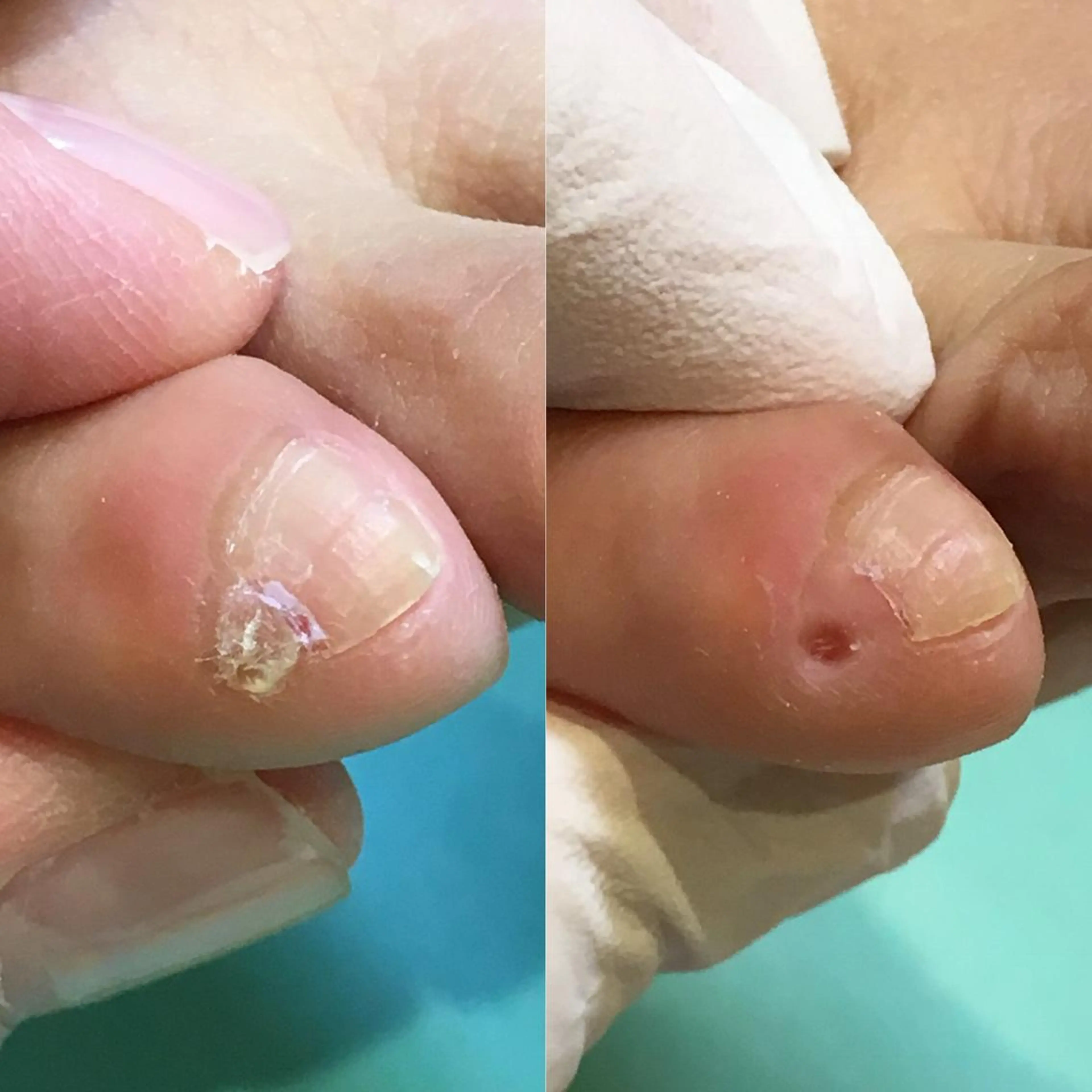 東京巻き爪アカデミー所属・東京巻き爪 アカデミーのエステ・リラクイメージ