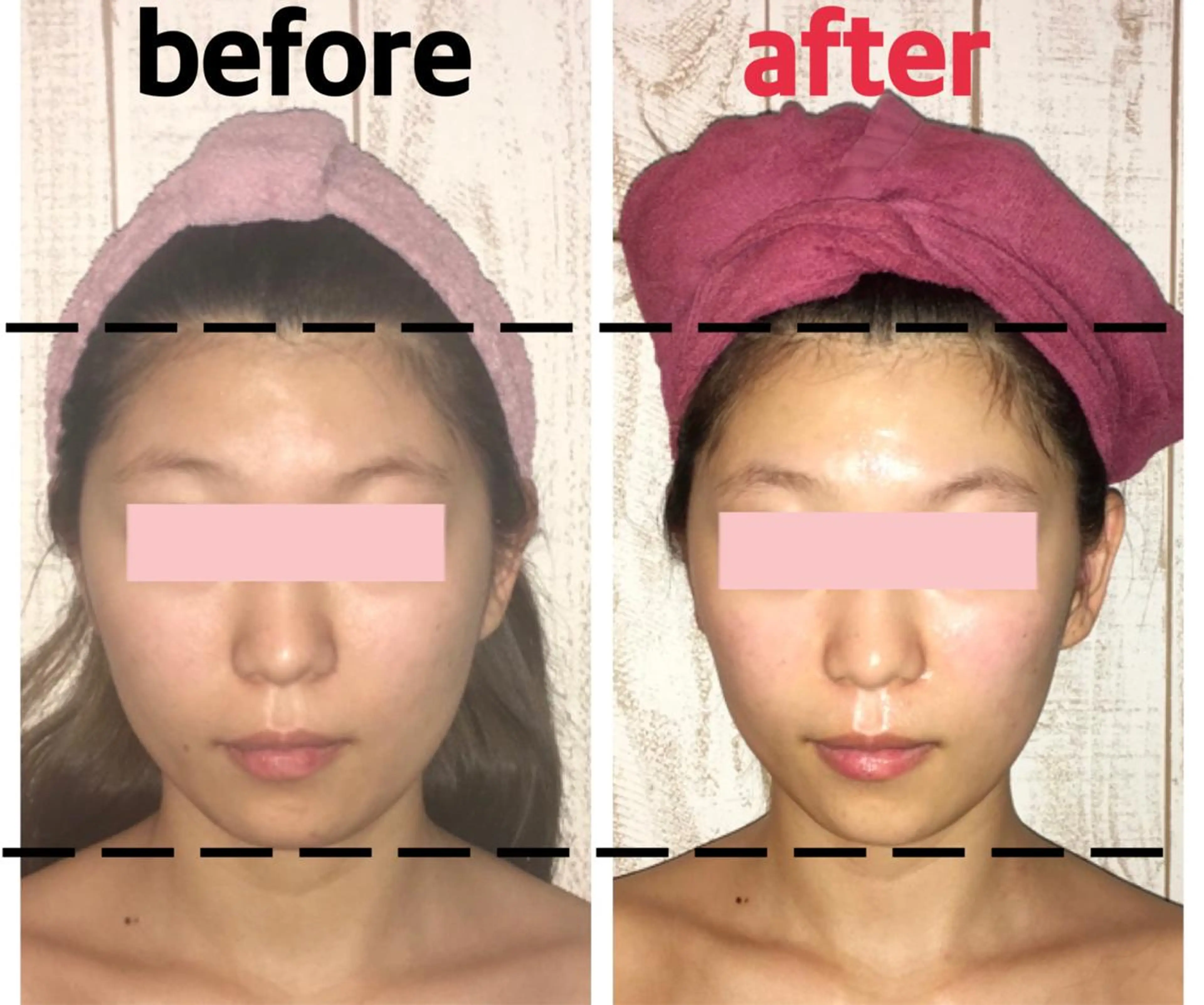 【本気の小顔、リフトアップ術☆】小顔整体コルギ+選べるオプション初回70分4500円😉の写真